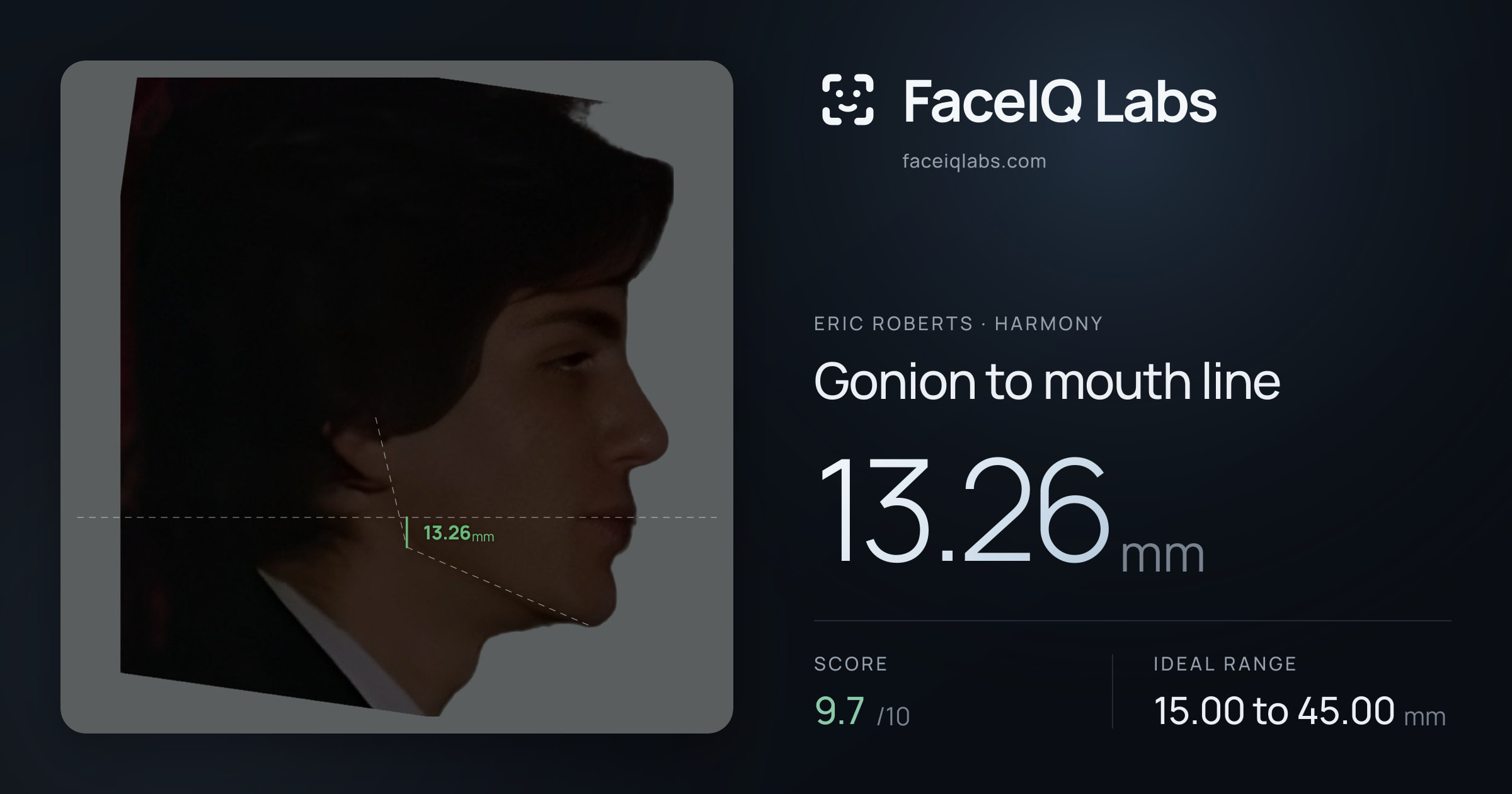 Eric Roberts Gonion to mouth line: 13.26mm, drawn on the photo