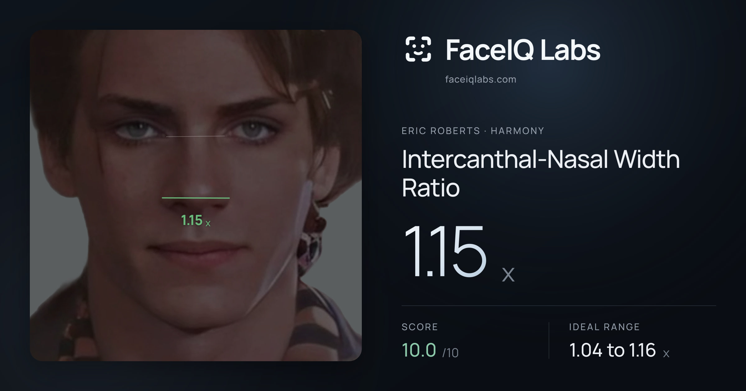 Eric Roberts Intercanthal-Nasal Width Ratio: 1.15x, drawn on the photo