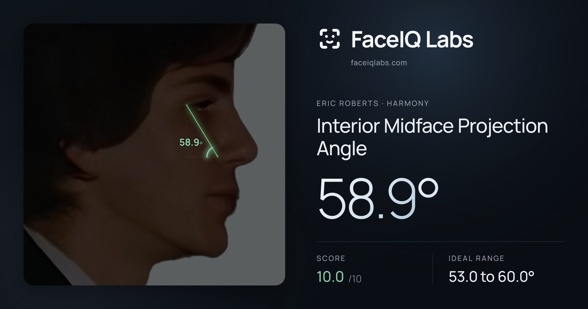 Eric Roberts Interior Midface Projection Angle: 58.9°, drawn on the photo