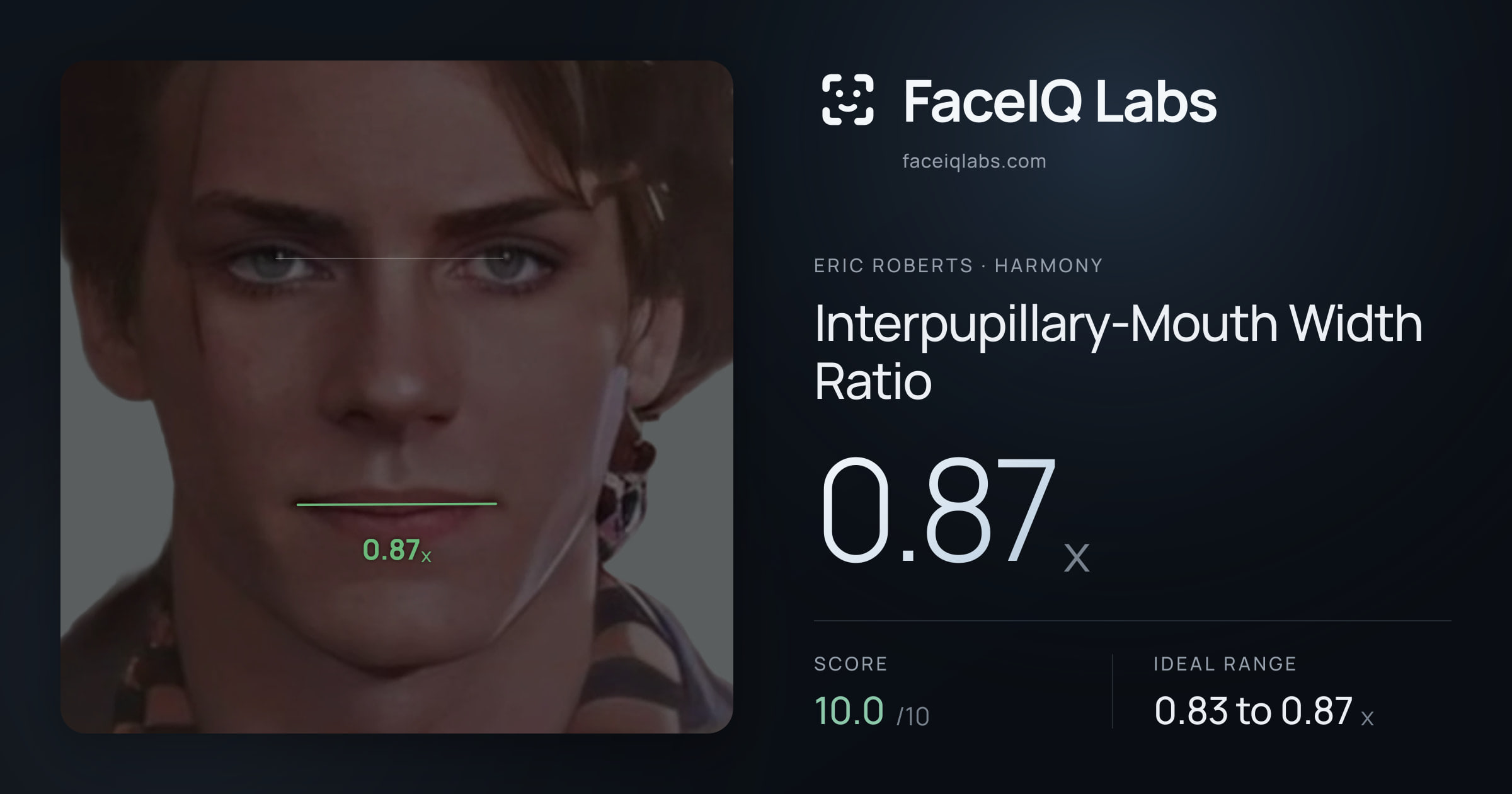Eric Roberts Interpupillary-Mouth Width Ratio: 0.87x, drawn on the photo