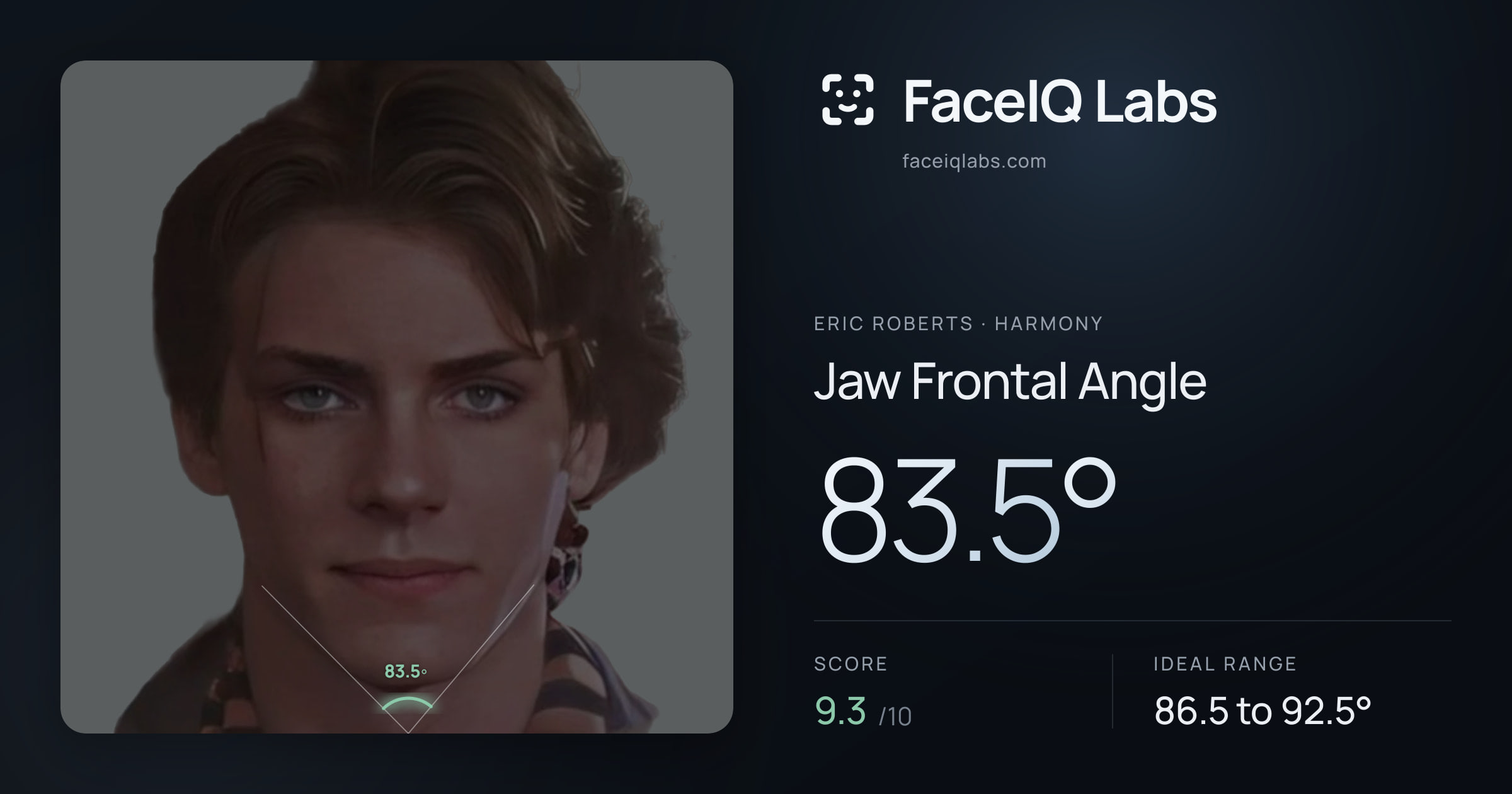 Eric Roberts Jaw Frontal Angle: 83.5°, drawn on the photo