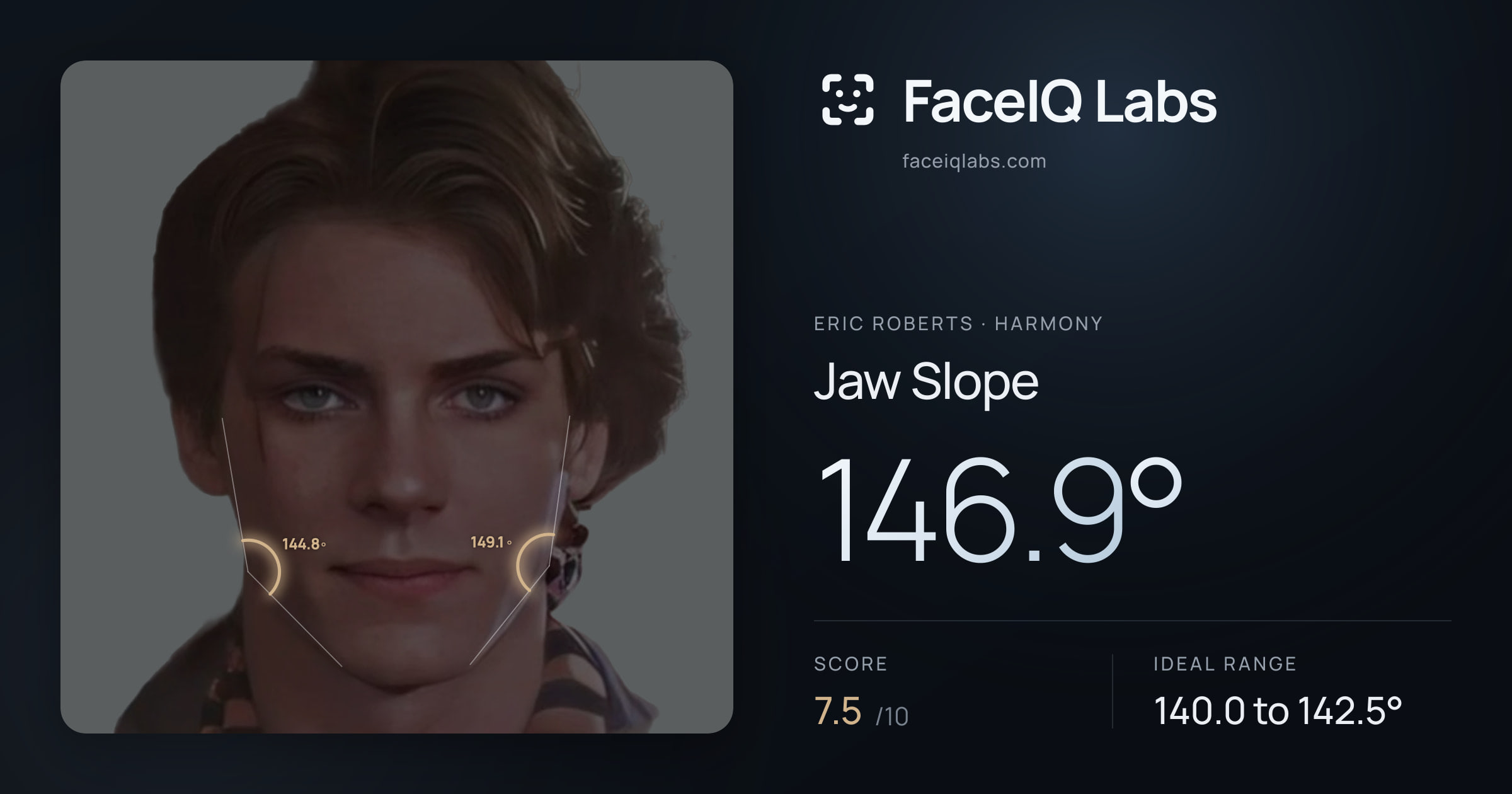 Eric Roberts Jaw Slope: 146.9°, drawn on the photo