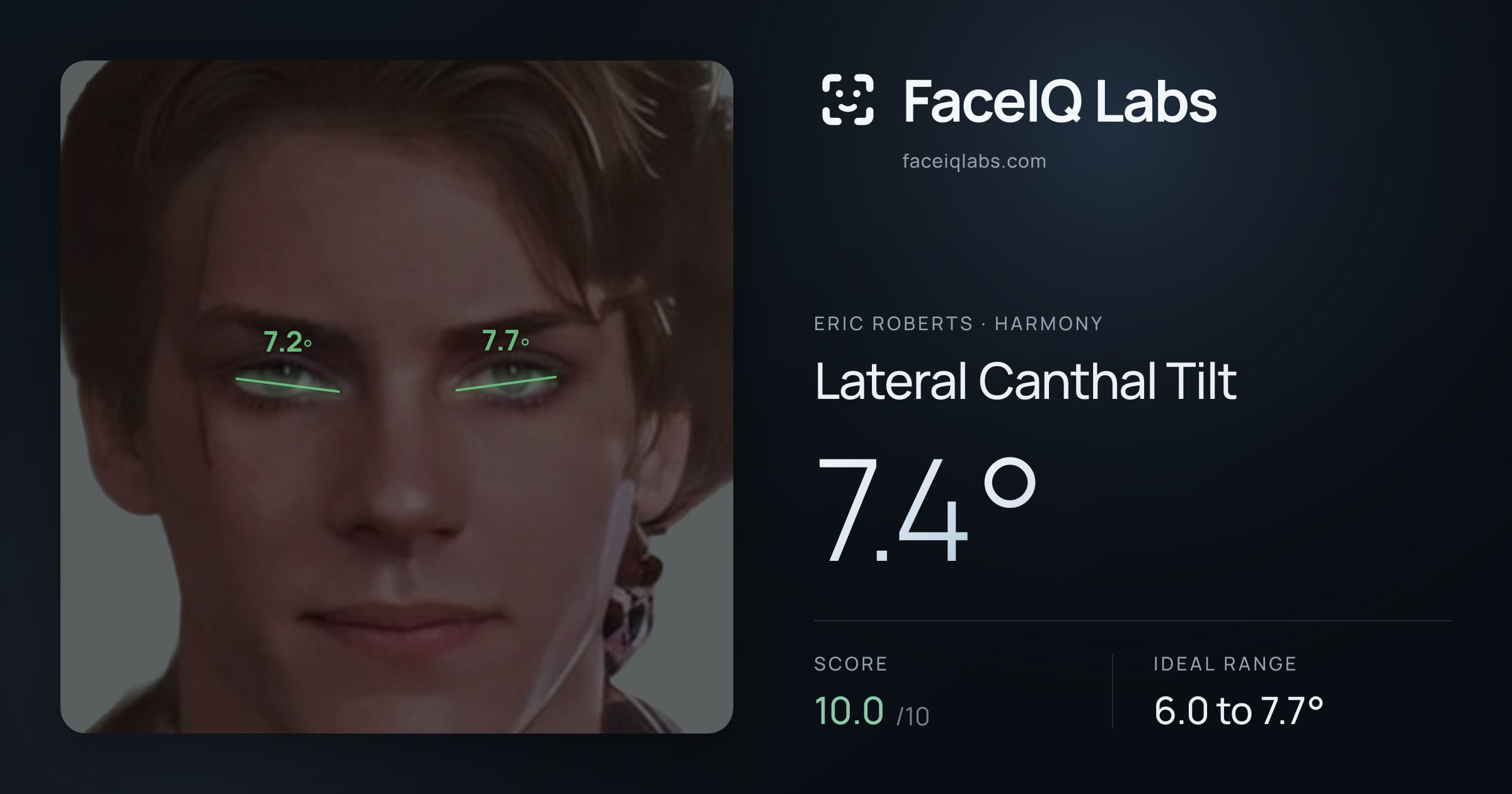 Eric Roberts Lateral Canthal Tilt: 7.4°, drawn on the photo