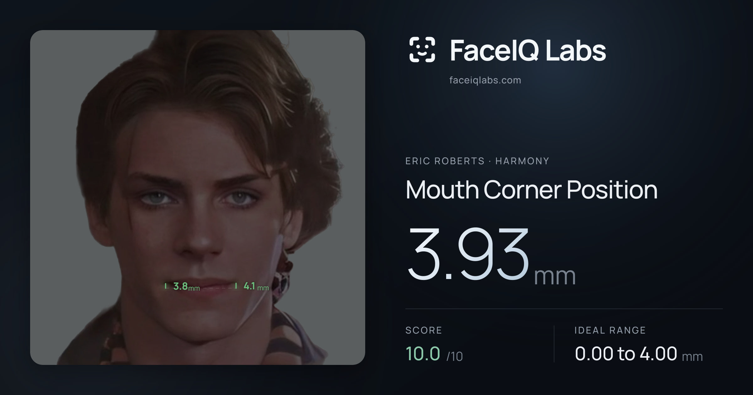 Eric Roberts Mouth Corner Position: 3.93mm, drawn on the photo