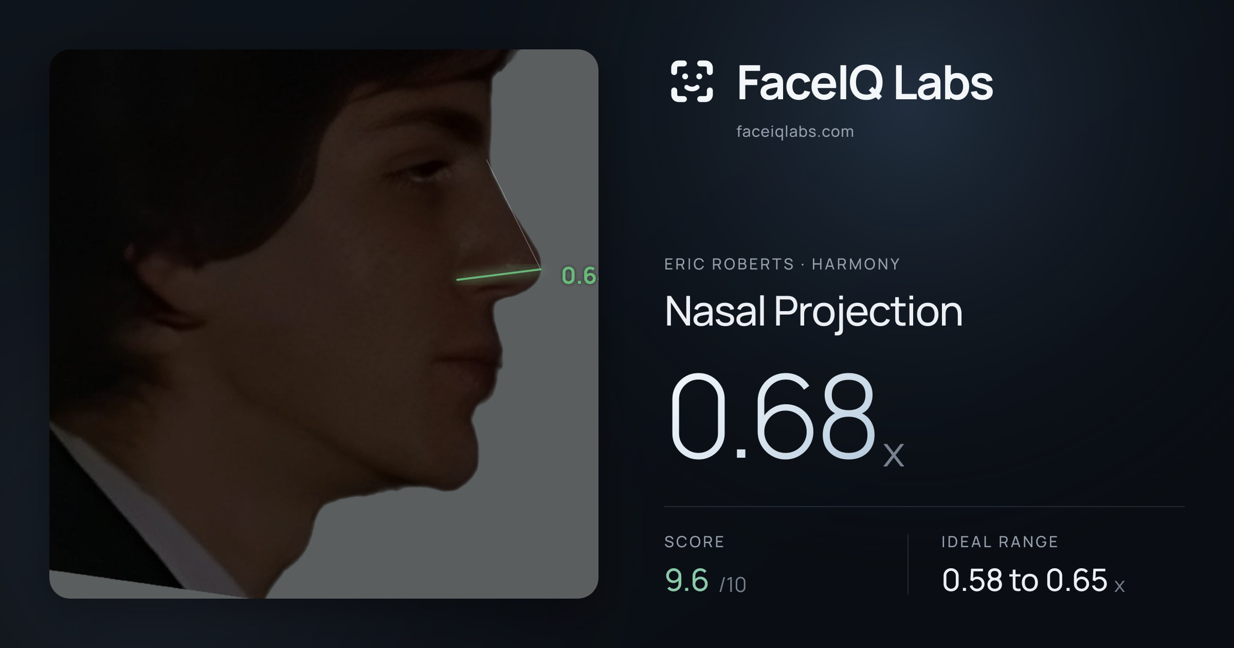 Eric Roberts Nasal Projection: 0.68x, drawn on the photo