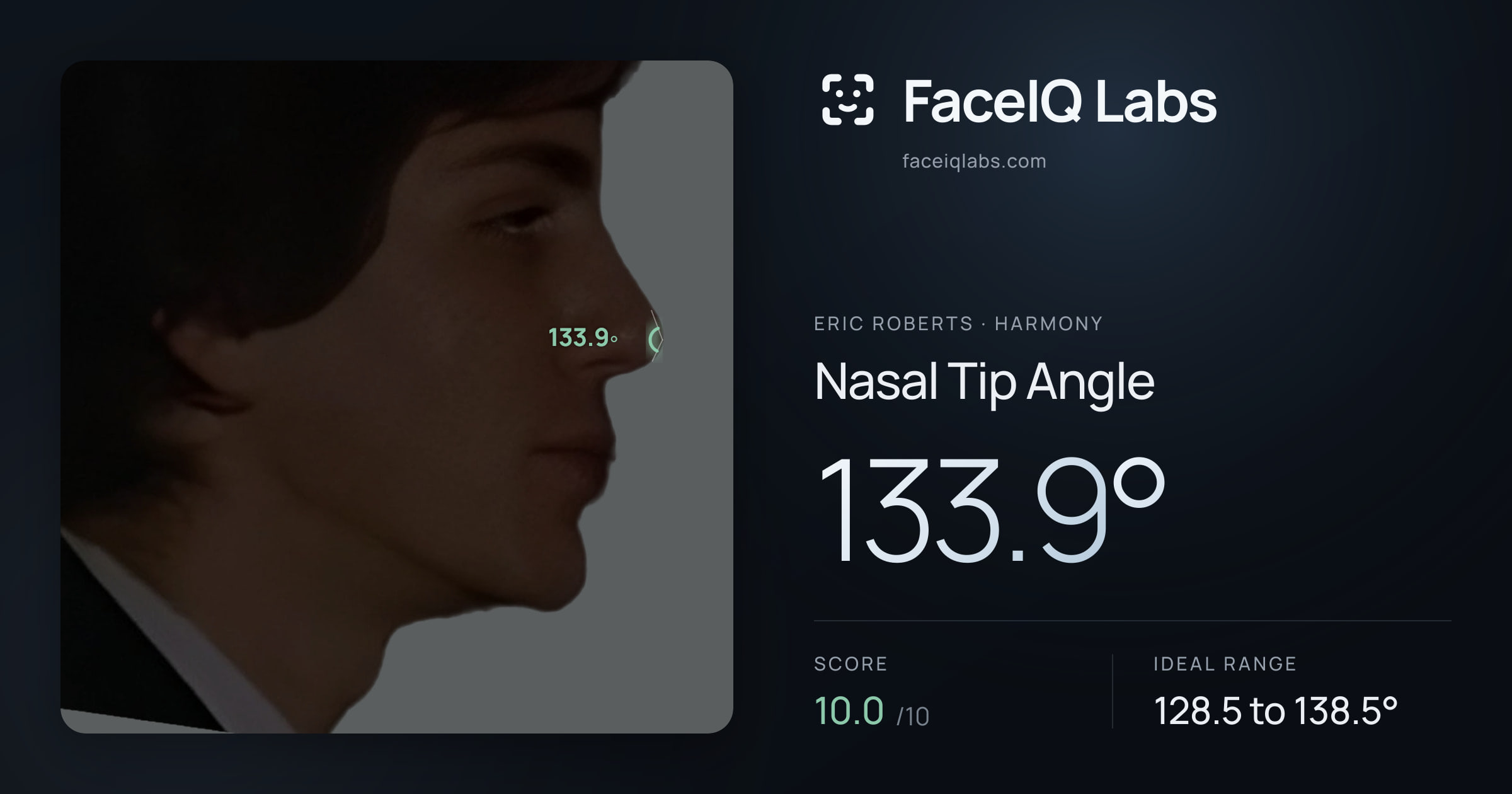 Eric Roberts Nasal Tip Angle: 133.9°, drawn on the photo