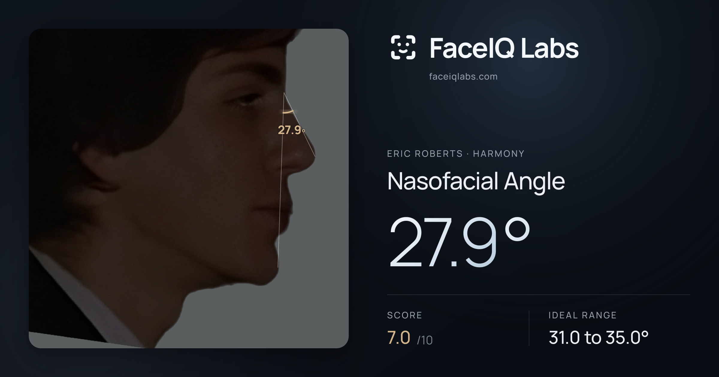 Eric Roberts Nasofacial Angle: 27.9°, drawn on the photo
