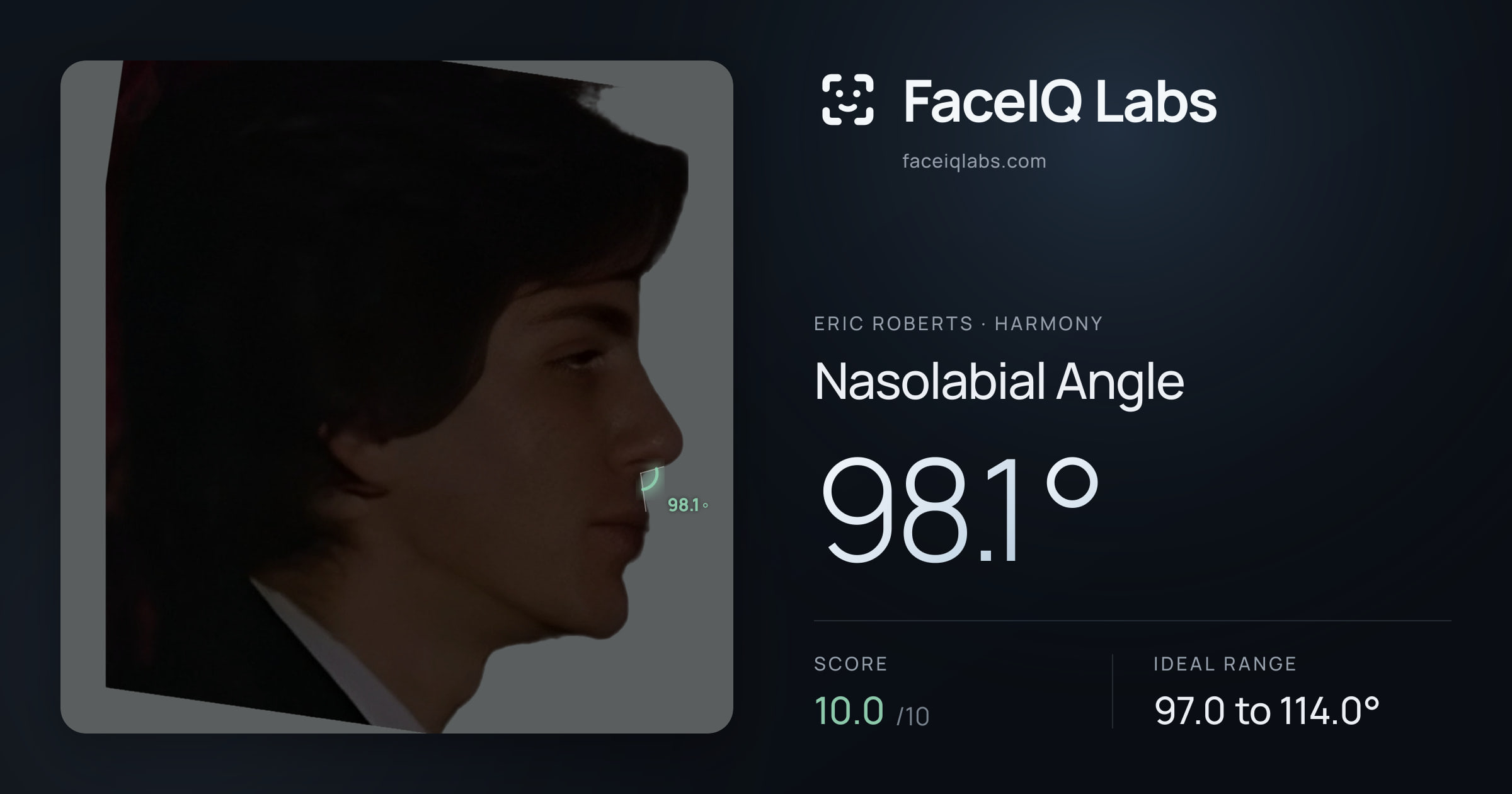 Eric Roberts Nasolabial Angle: 98.1°, drawn on the photo