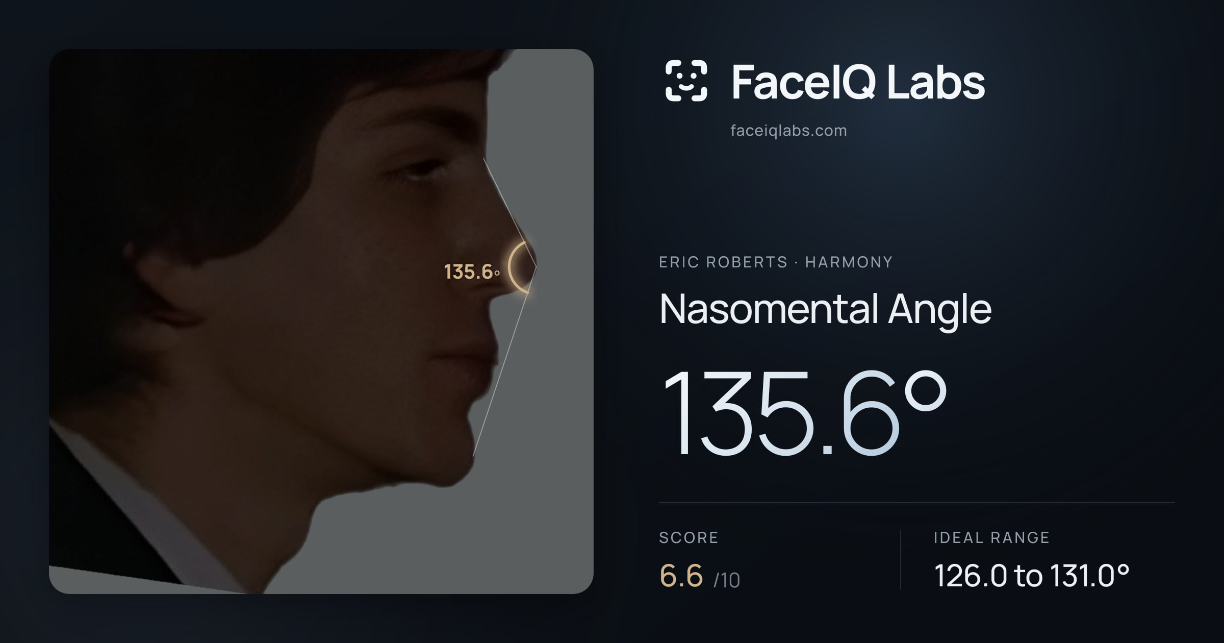 Eric Roberts Nasomental Angle: 135.6°, drawn on the photo