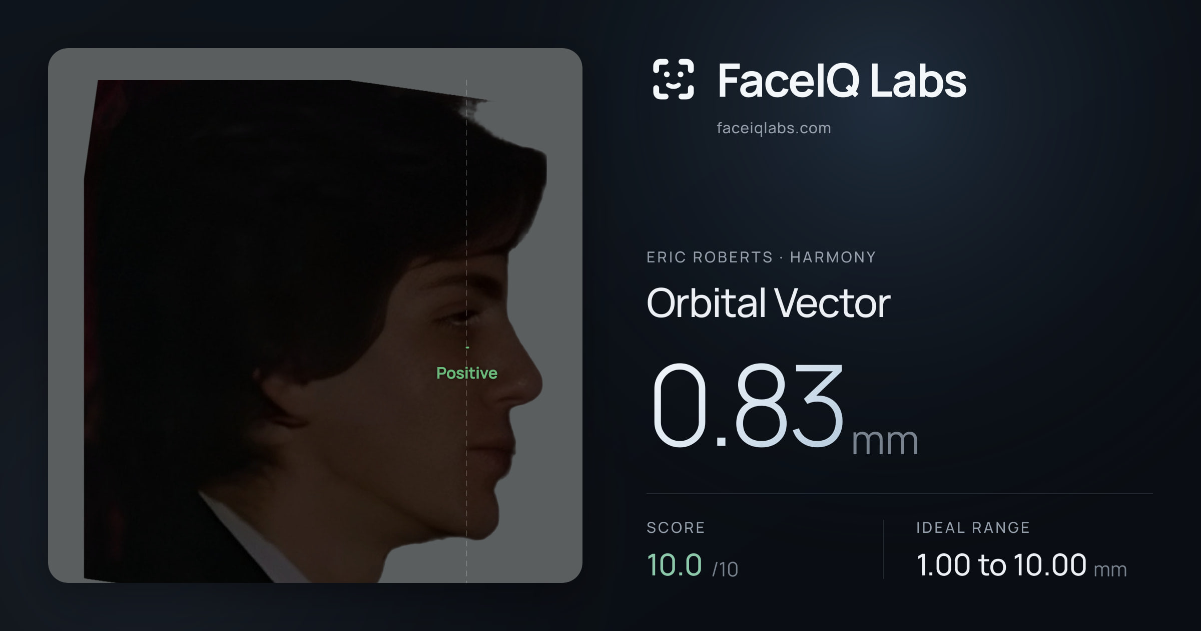 Eric Roberts Orbital Vector: 0.83mm, drawn on the photo
