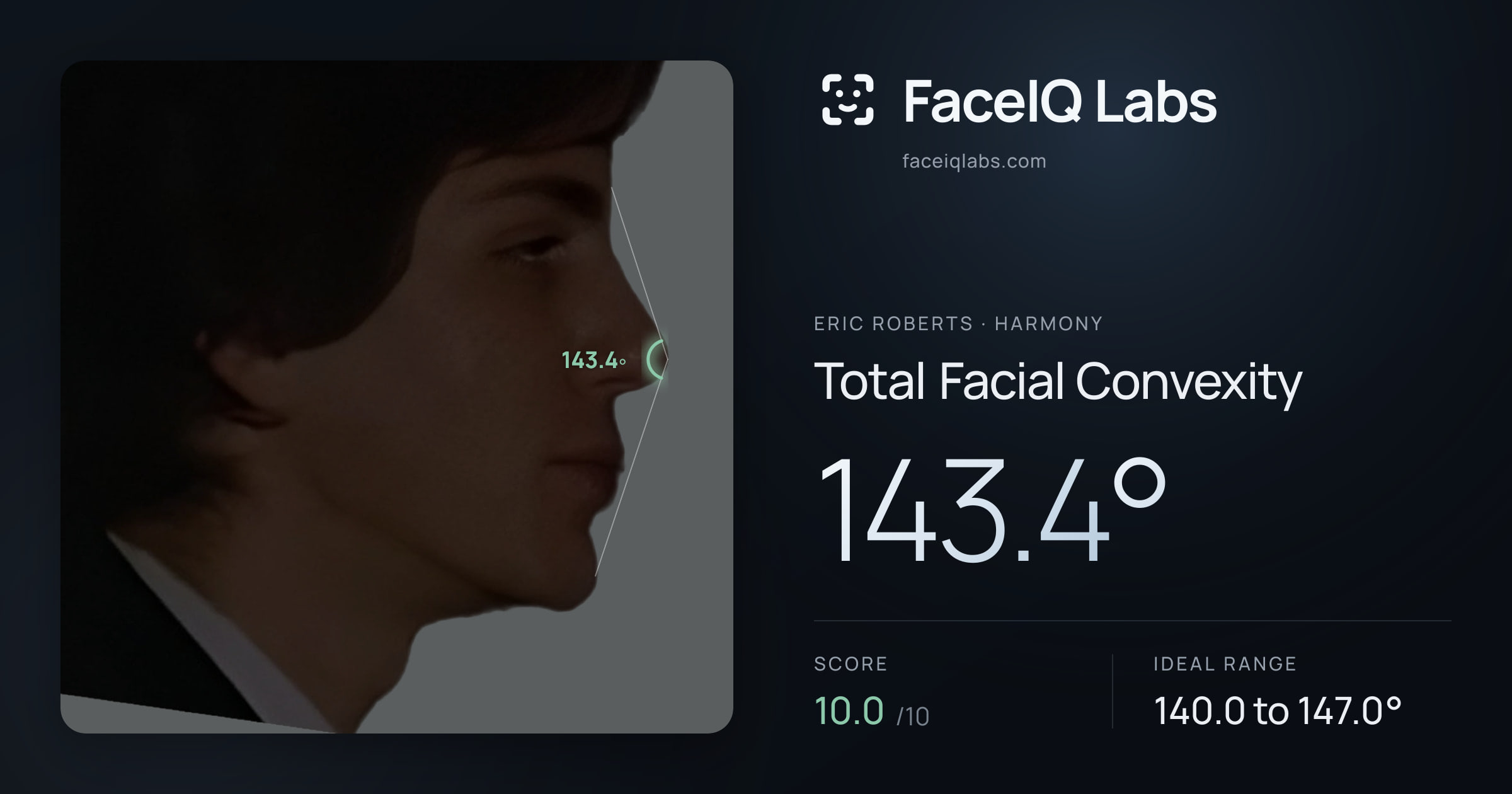 Eric Roberts Total Facial Convexity: 143.4°, drawn on the photo
