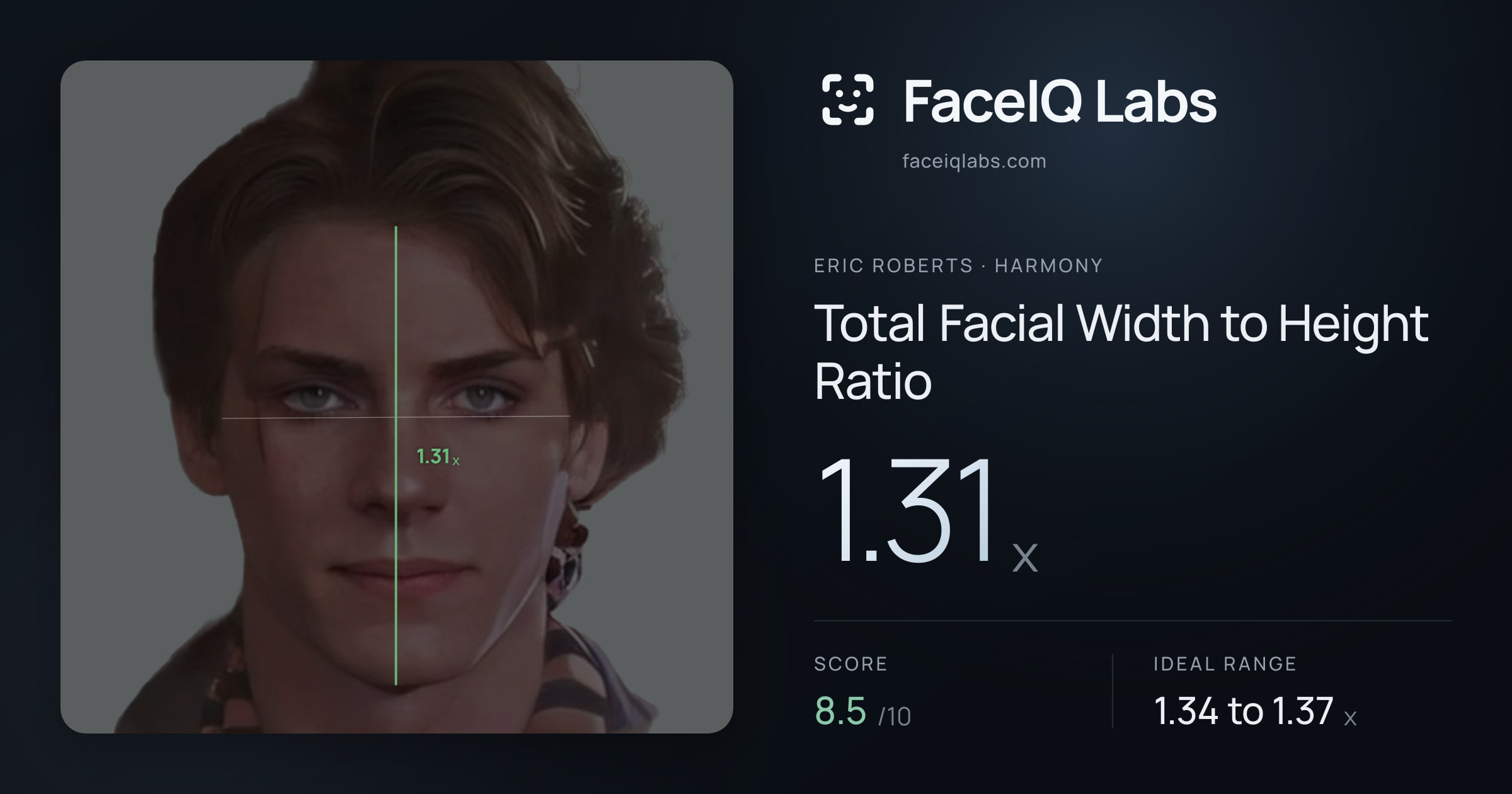 Eric Roberts Total Facial Width to Height Ratio: 1.31x, drawn on the photo