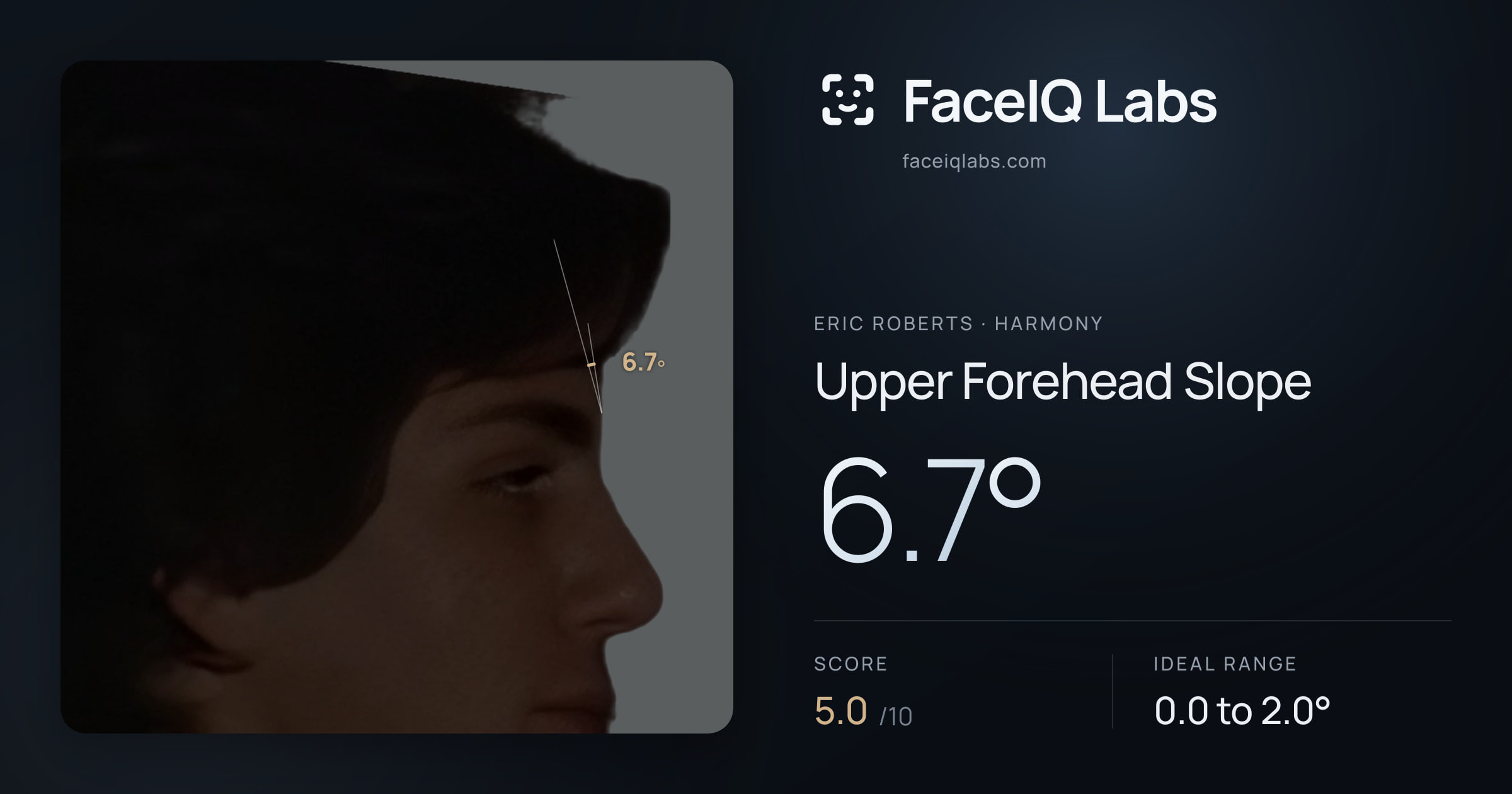 Eric Roberts Upper Forehead Slope: 6.7°, drawn on the photo
