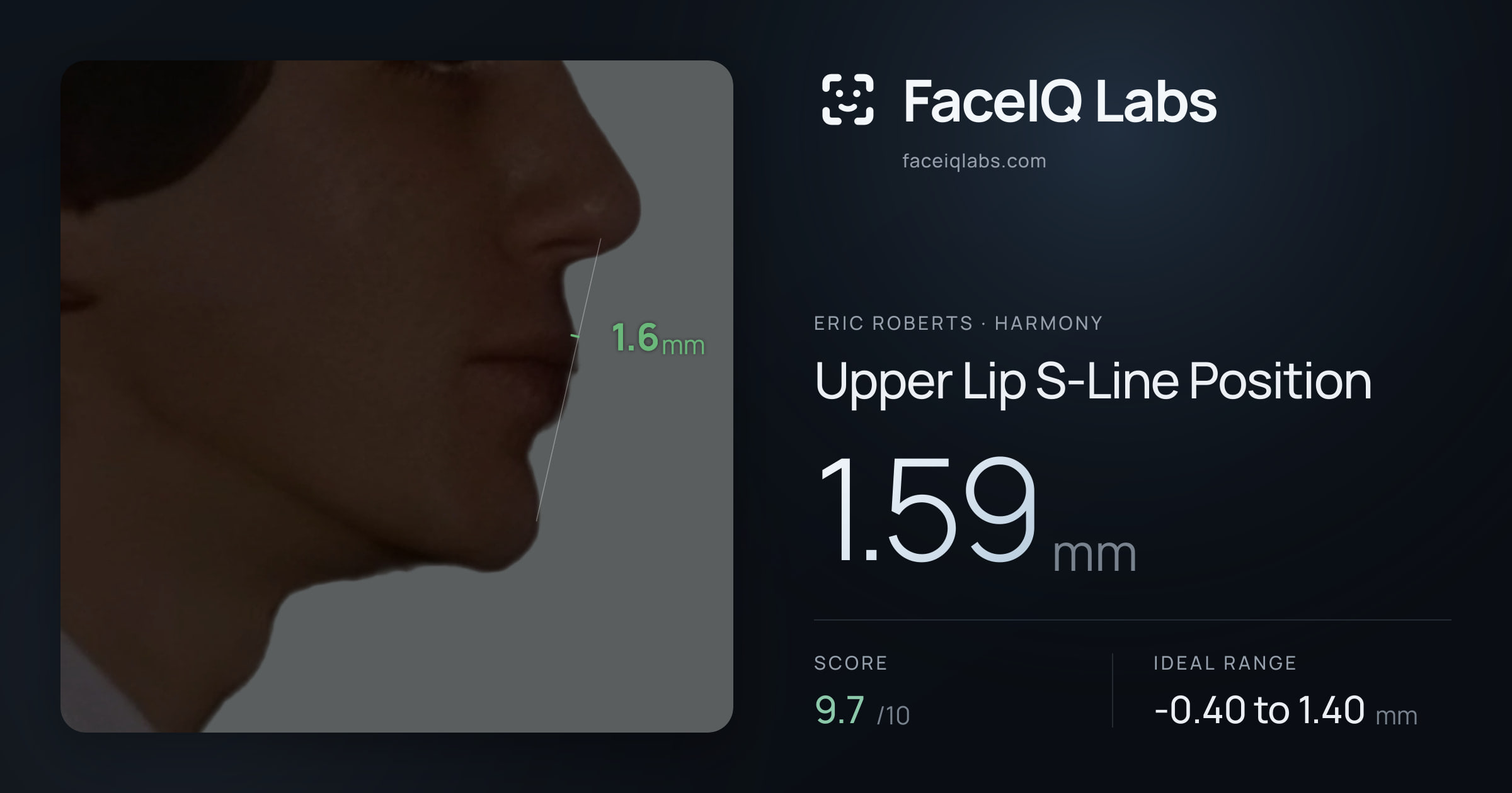 Eric Roberts Upper Lip S-Line Position: 1.59mm, drawn on the photo
