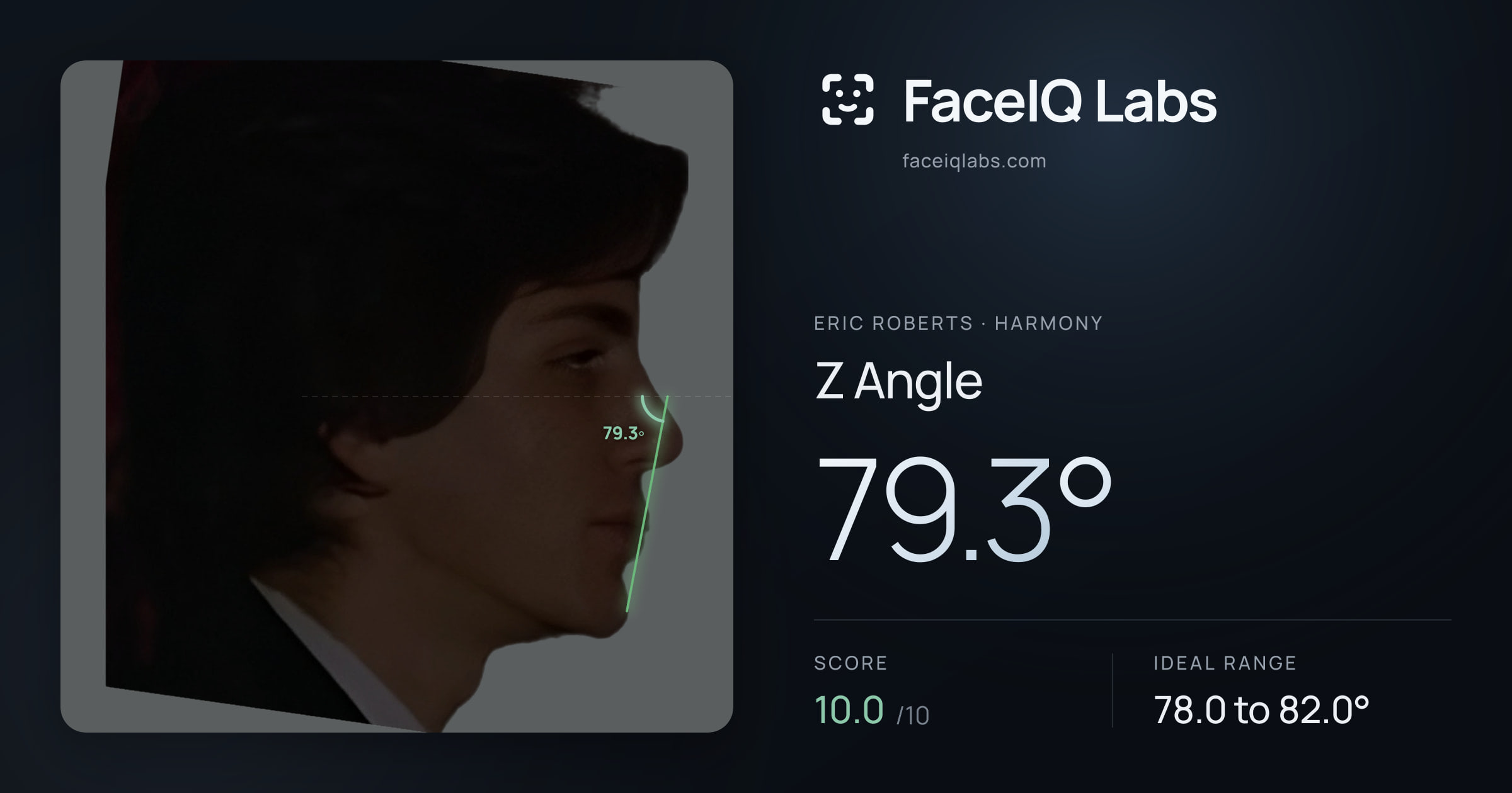 Eric Roberts Z Angle: 79.3°, drawn on the photo