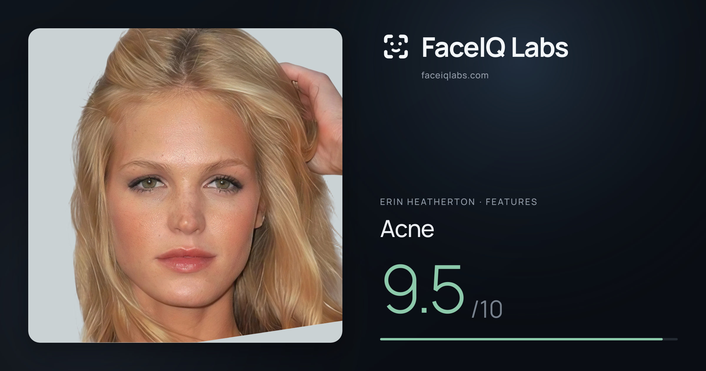 Erin Heatherton Acne: 9.5/10, drawn on the photo