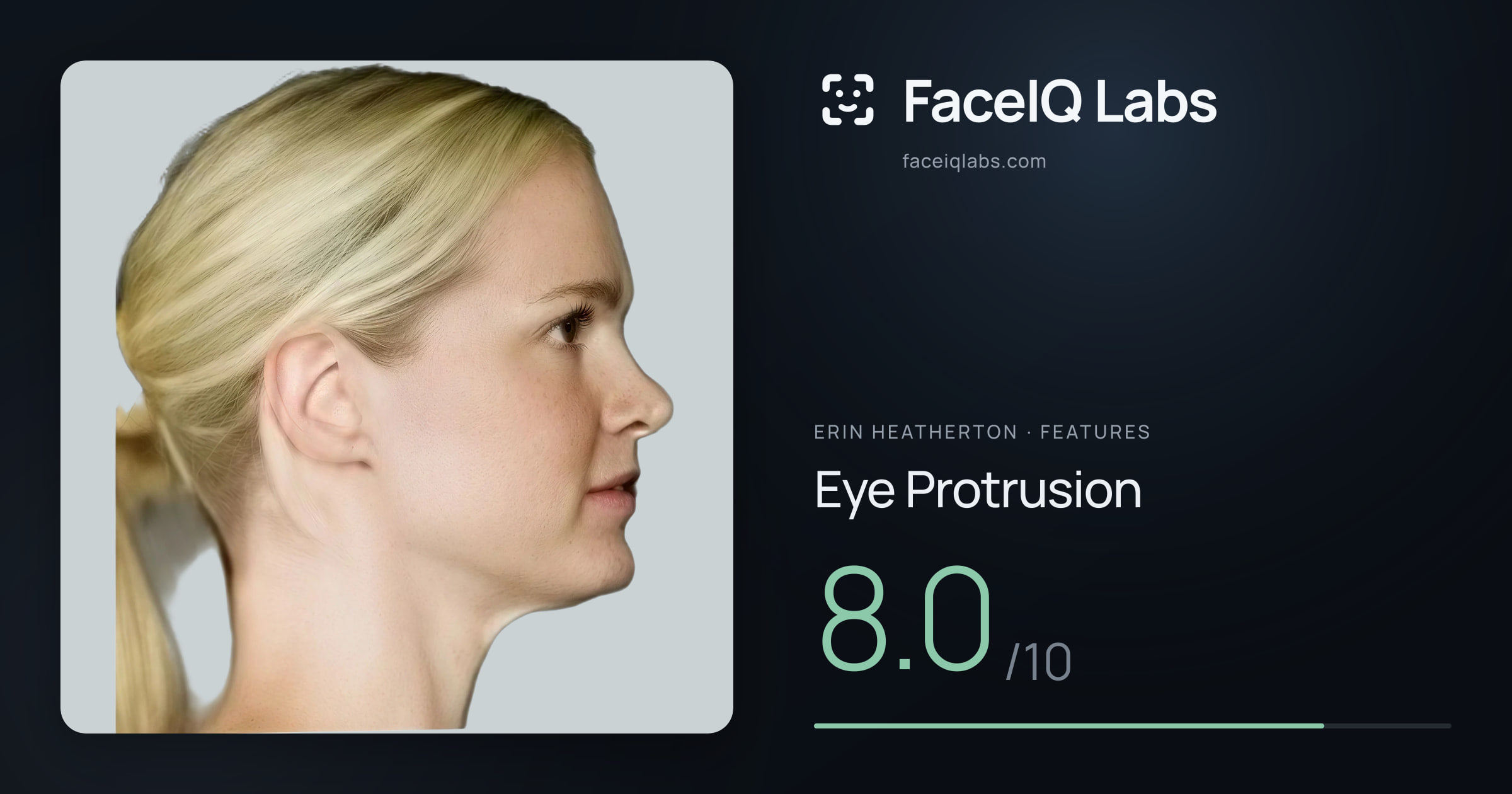 Erin Heatherton Eye Protrusion: 8.0/10, drawn on the photo