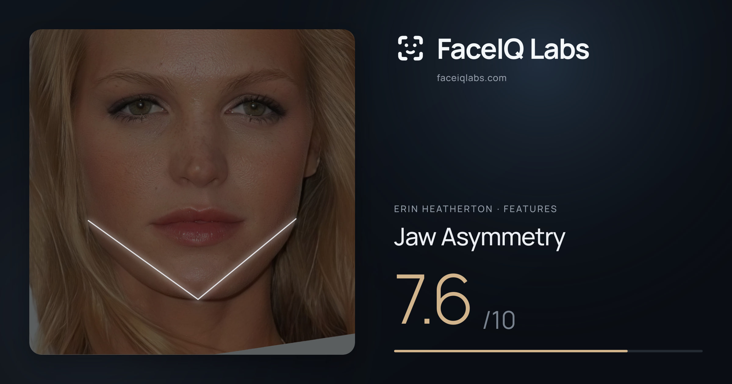 Erin Heatherton Jaw Asymmetry: 7.6/10, drawn on the photo