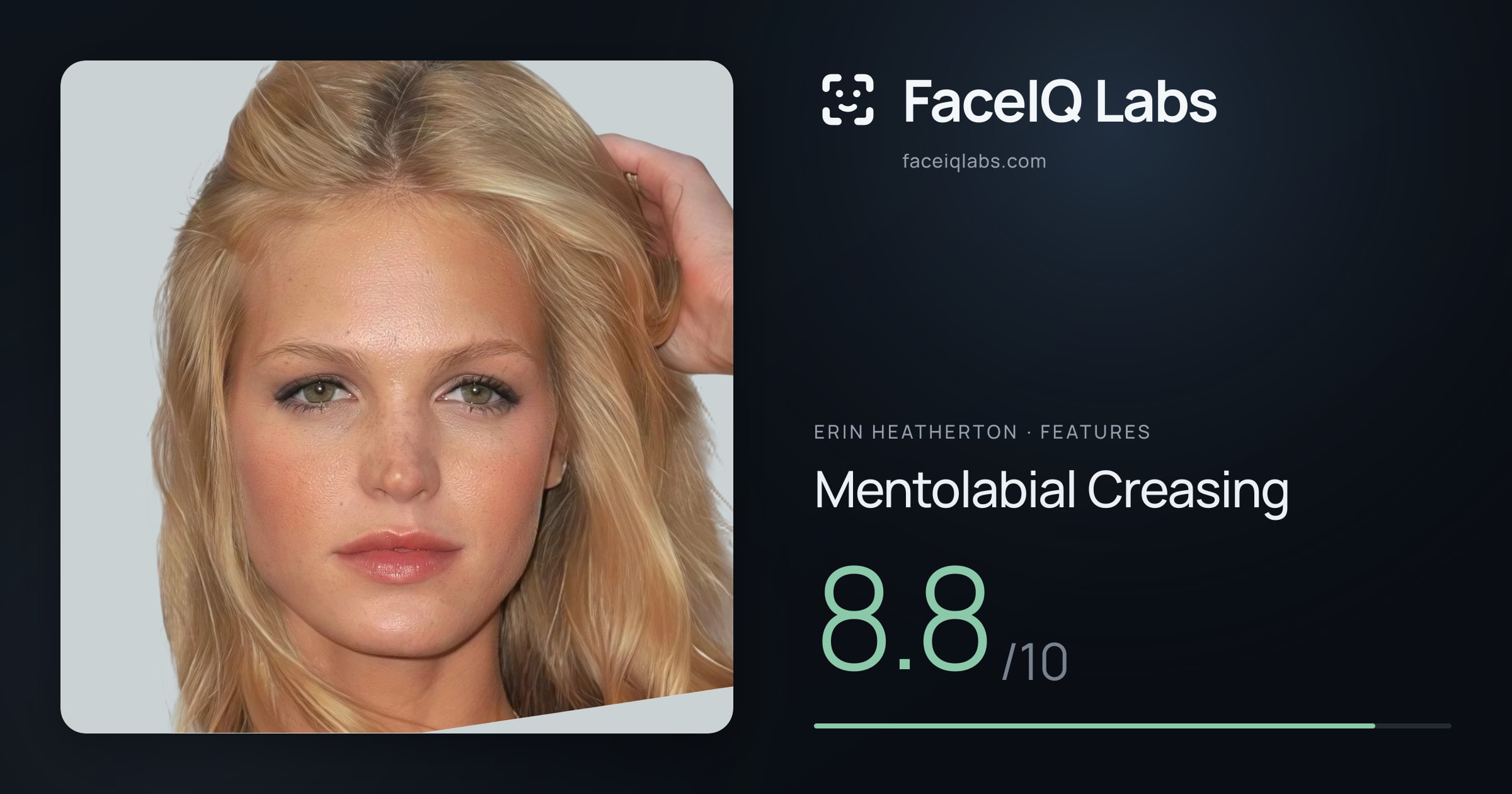 Erin Heatherton Mentolabial Creasing: 8.8/10, drawn on the photo