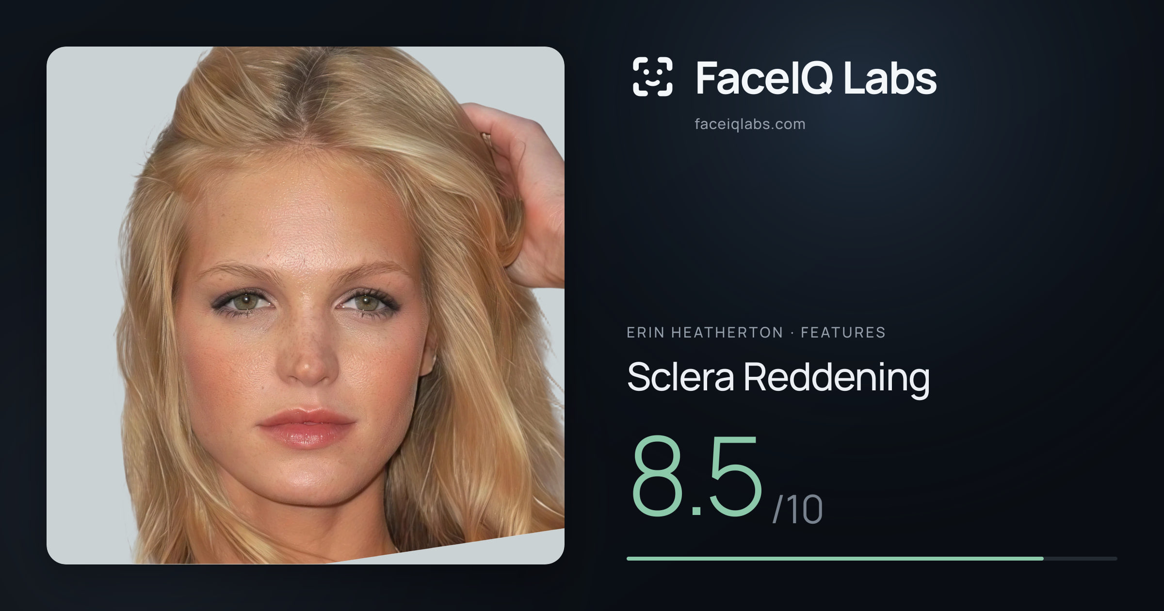 Erin Heatherton Sclera Reddening: 8.5/10, drawn on the photo
