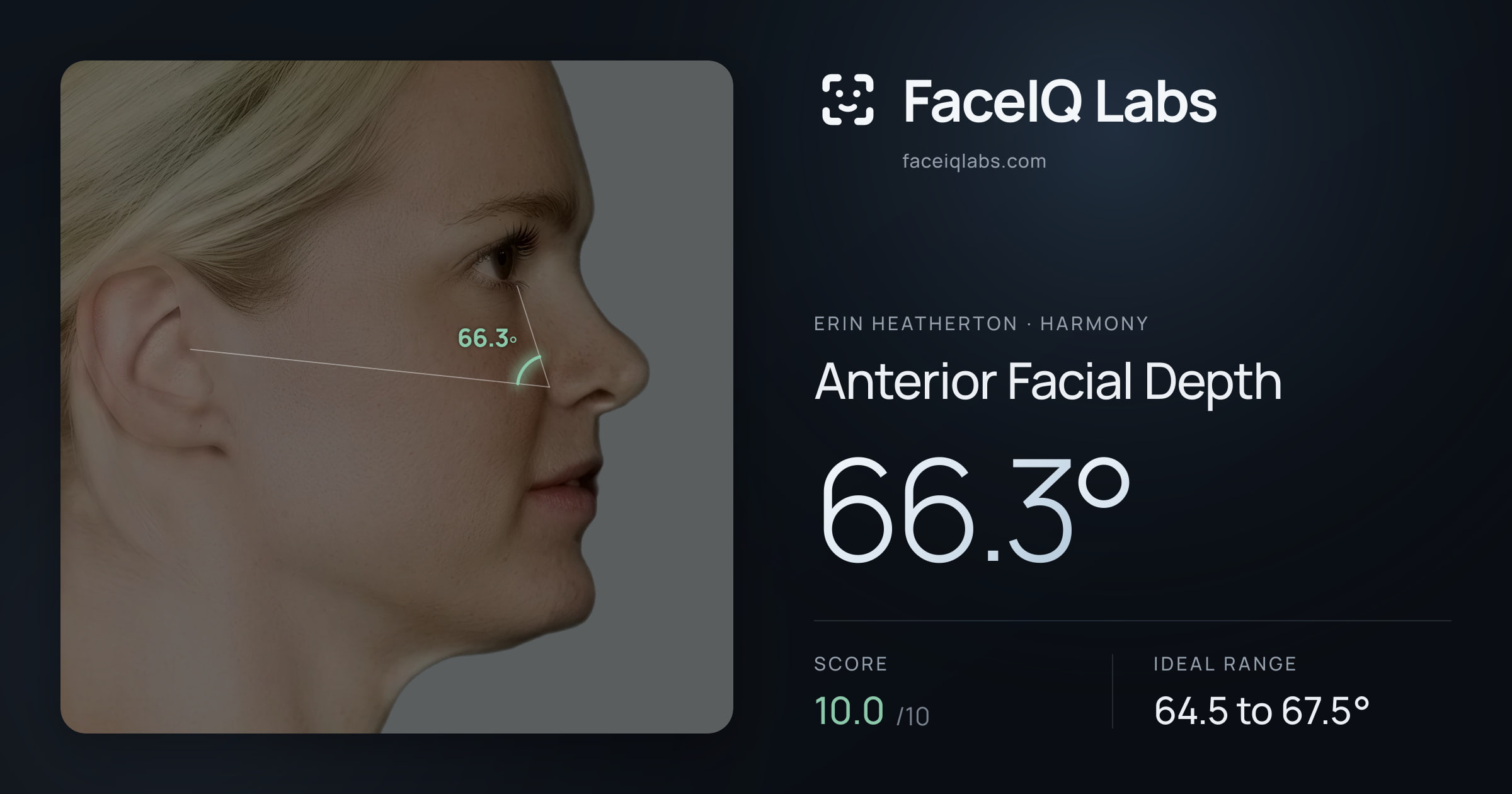 Erin Heatherton Anterior Facial Depth: 66.3°, drawn on the photo