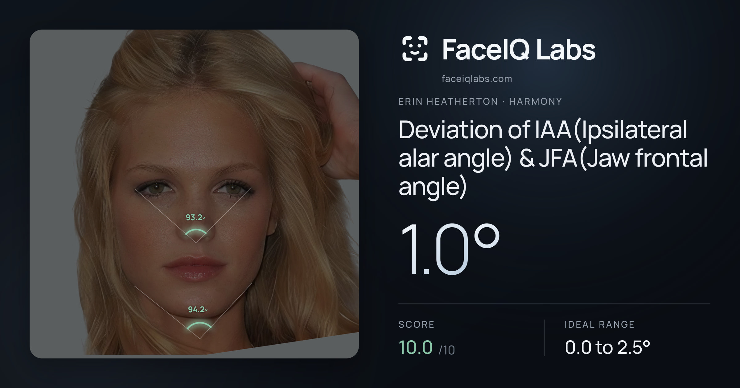 Erin Heatherton Deviation of IAA(Ipsilateral alar angle) & JFA(Jaw frontal angle): 1.0°, drawn on the photo