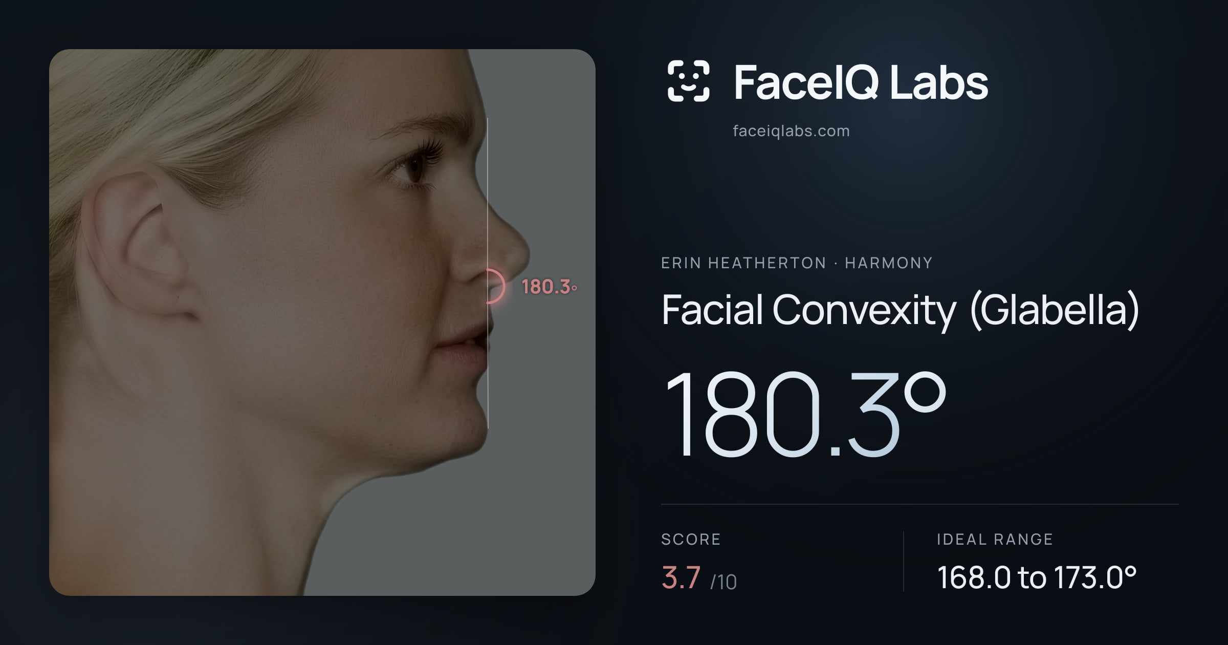 Erin Heatherton Facial Convexity (Glabella): 180.3°, drawn on the photo