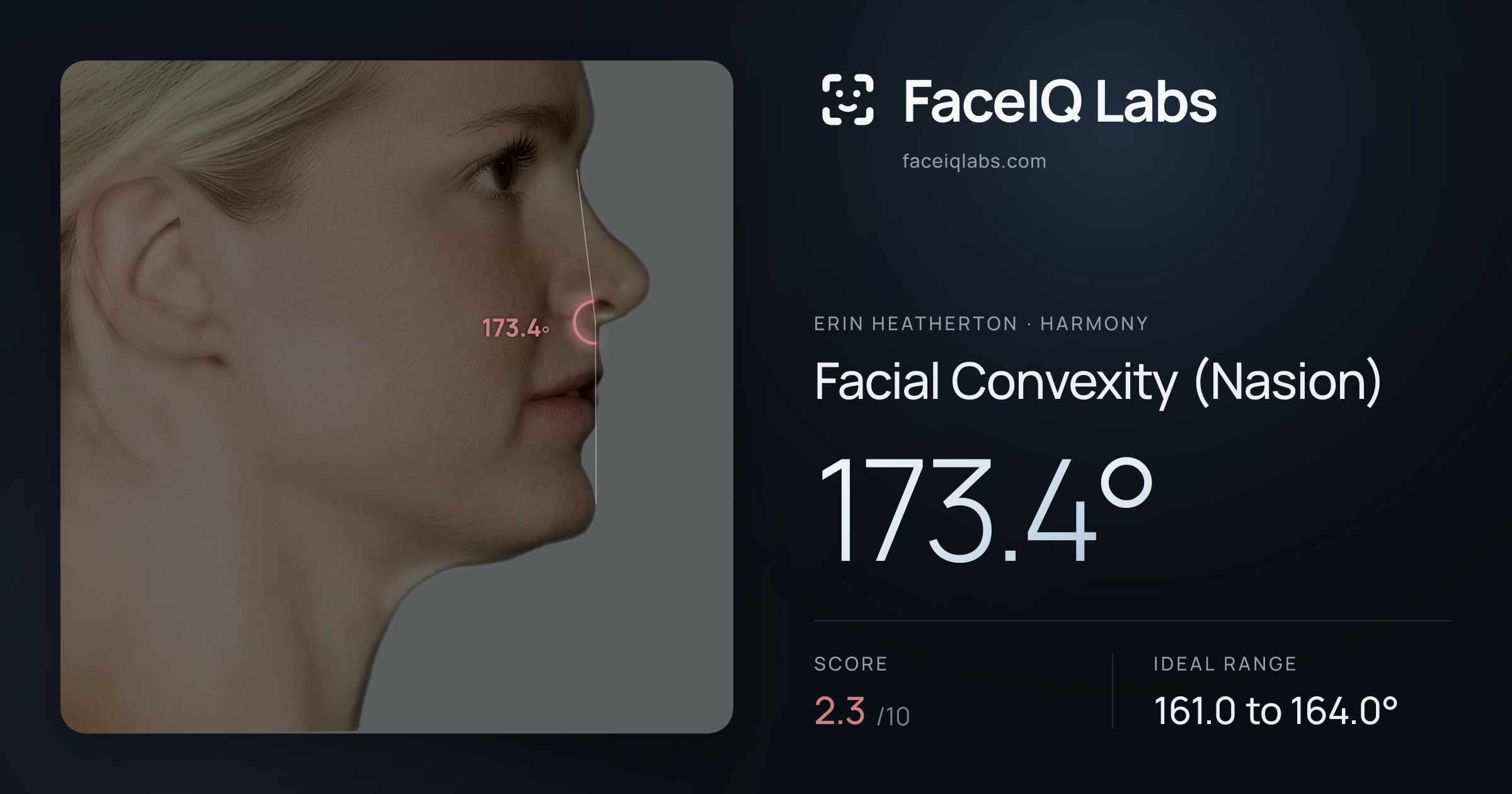 Erin Heatherton Facial Convexity (Nasion): 173.4°, drawn on the photo