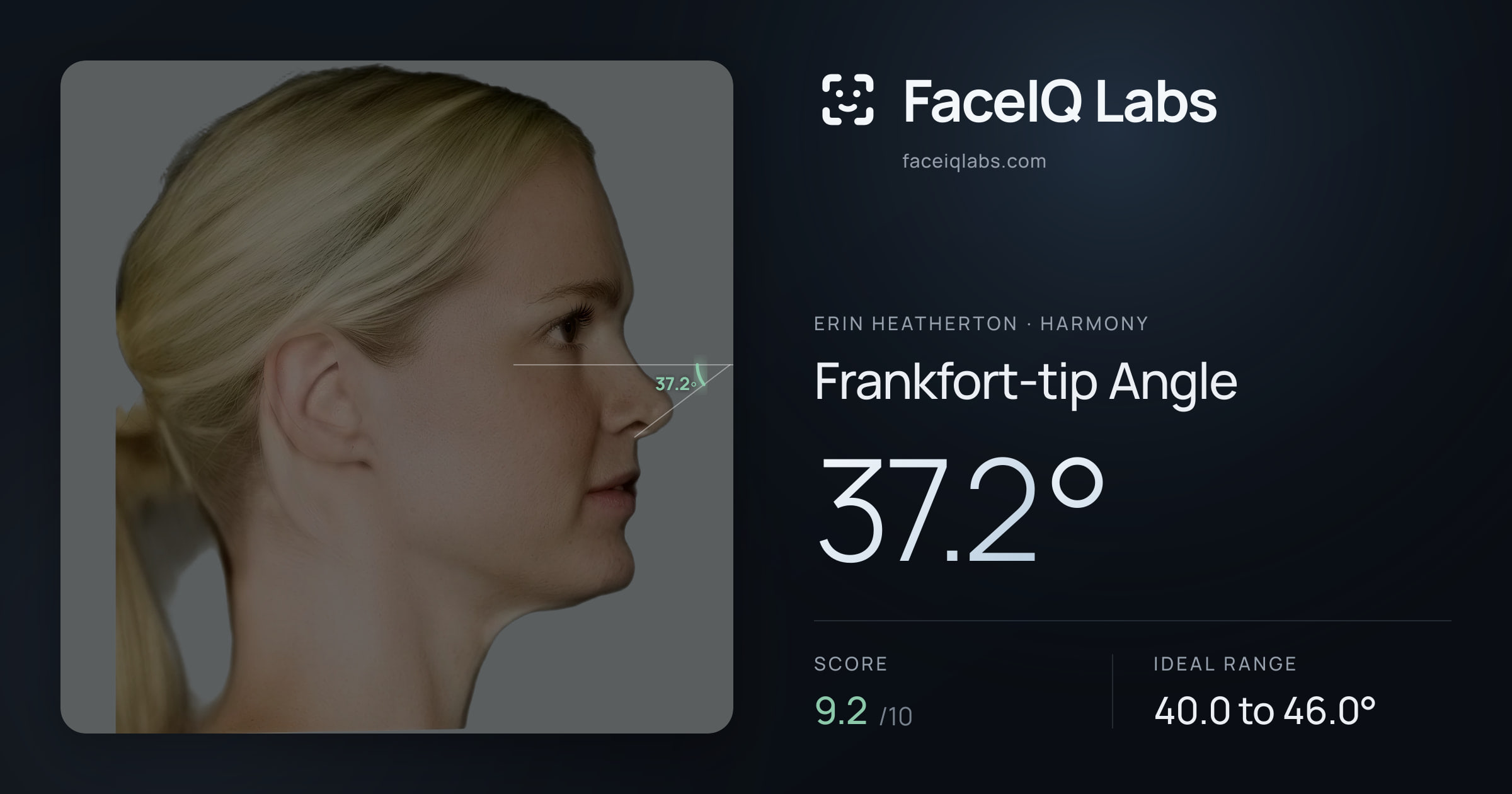 Erin Heatherton Frankfort-tip Angle: 37.2°, drawn on the photo