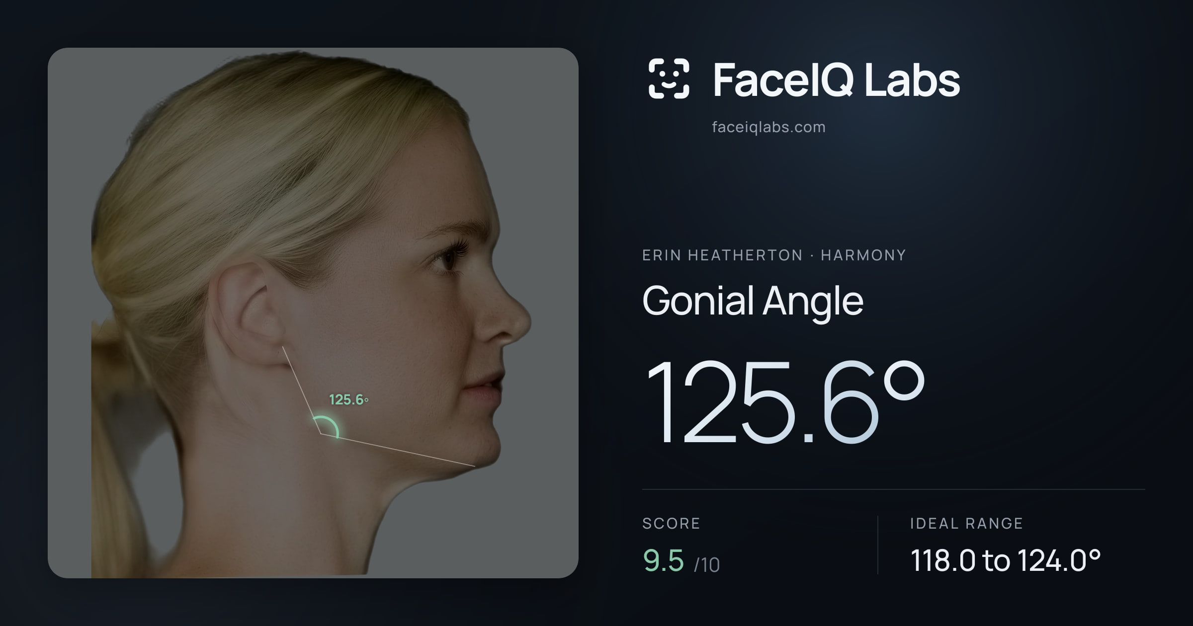 Erin Heatherton Gonial Angle: 125.6°, drawn on the photo