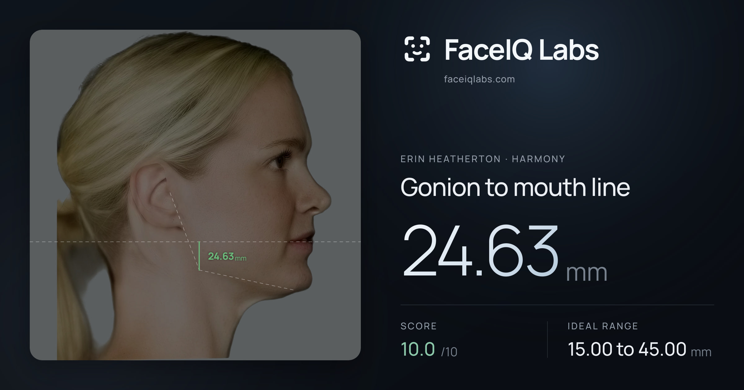 Erin Heatherton Gonion to mouth line: 24.63mm, drawn on the photo