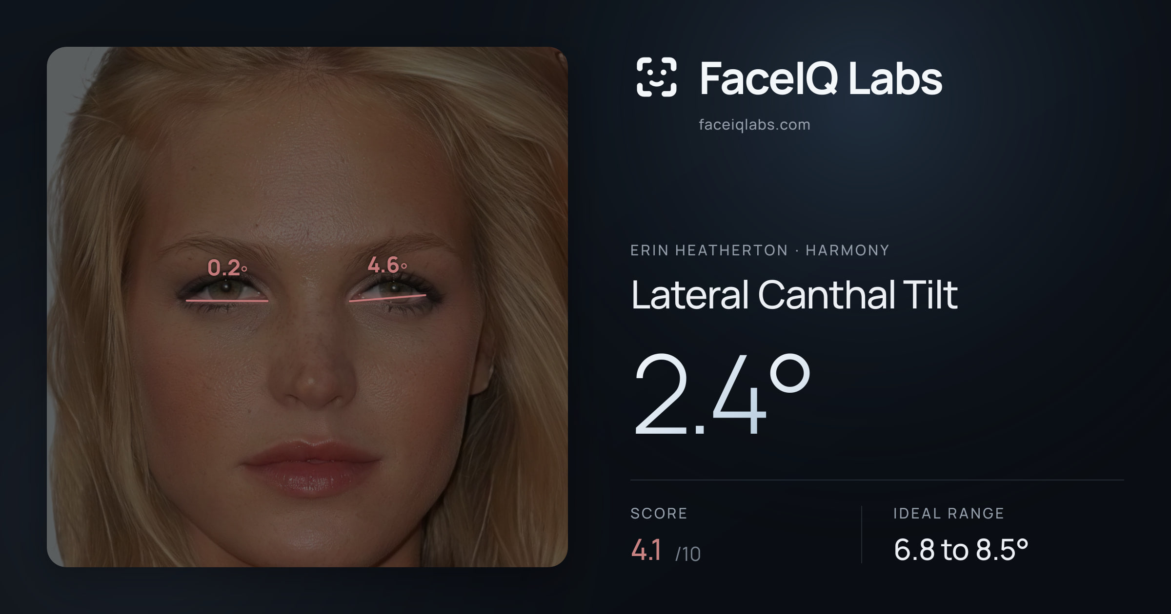 Erin Heatherton Lateral Canthal Tilt: 2.4°, drawn on the photo