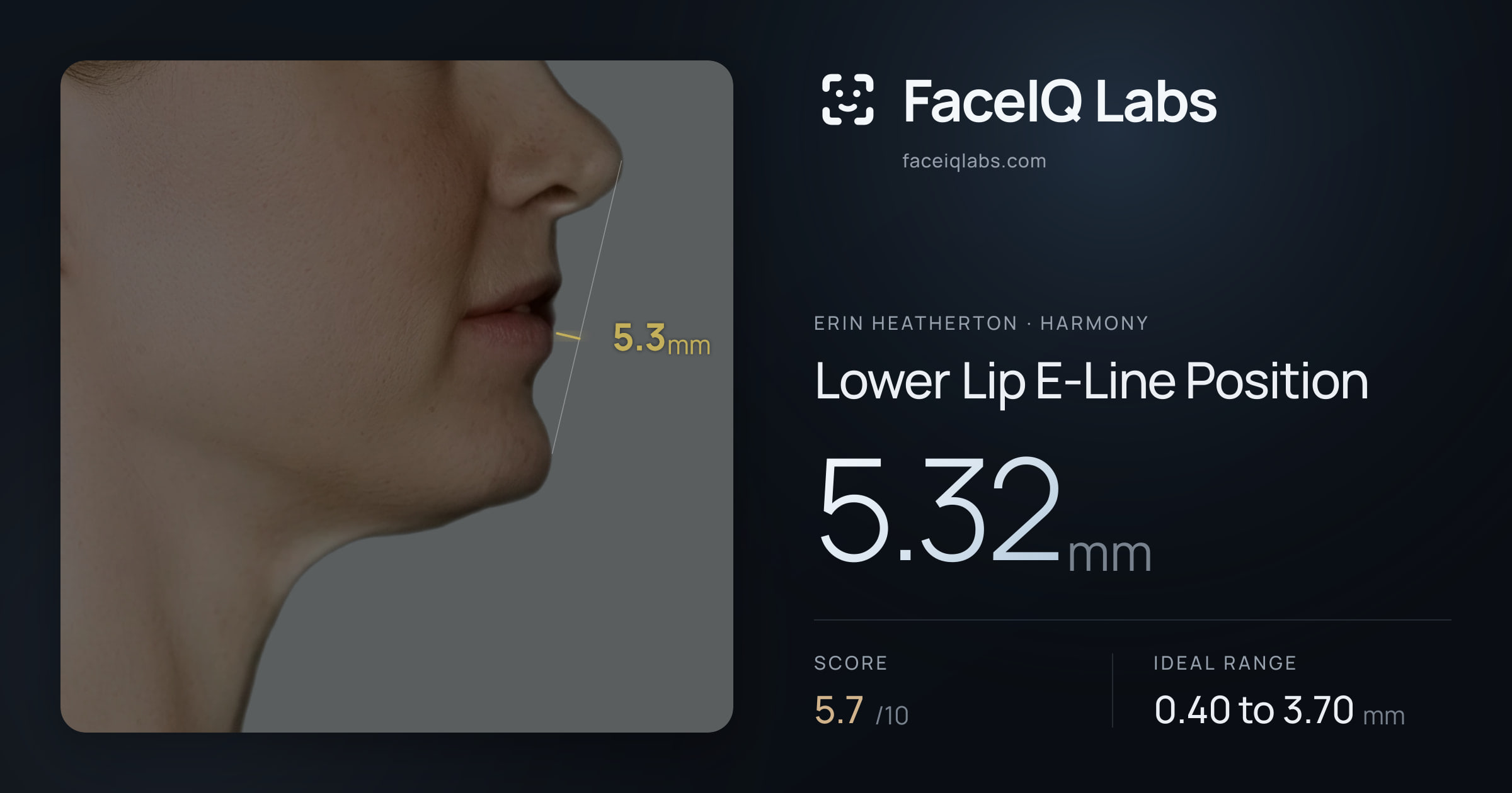 Erin Heatherton Lower Lip E-Line Position: 5.32mm, drawn on the photo