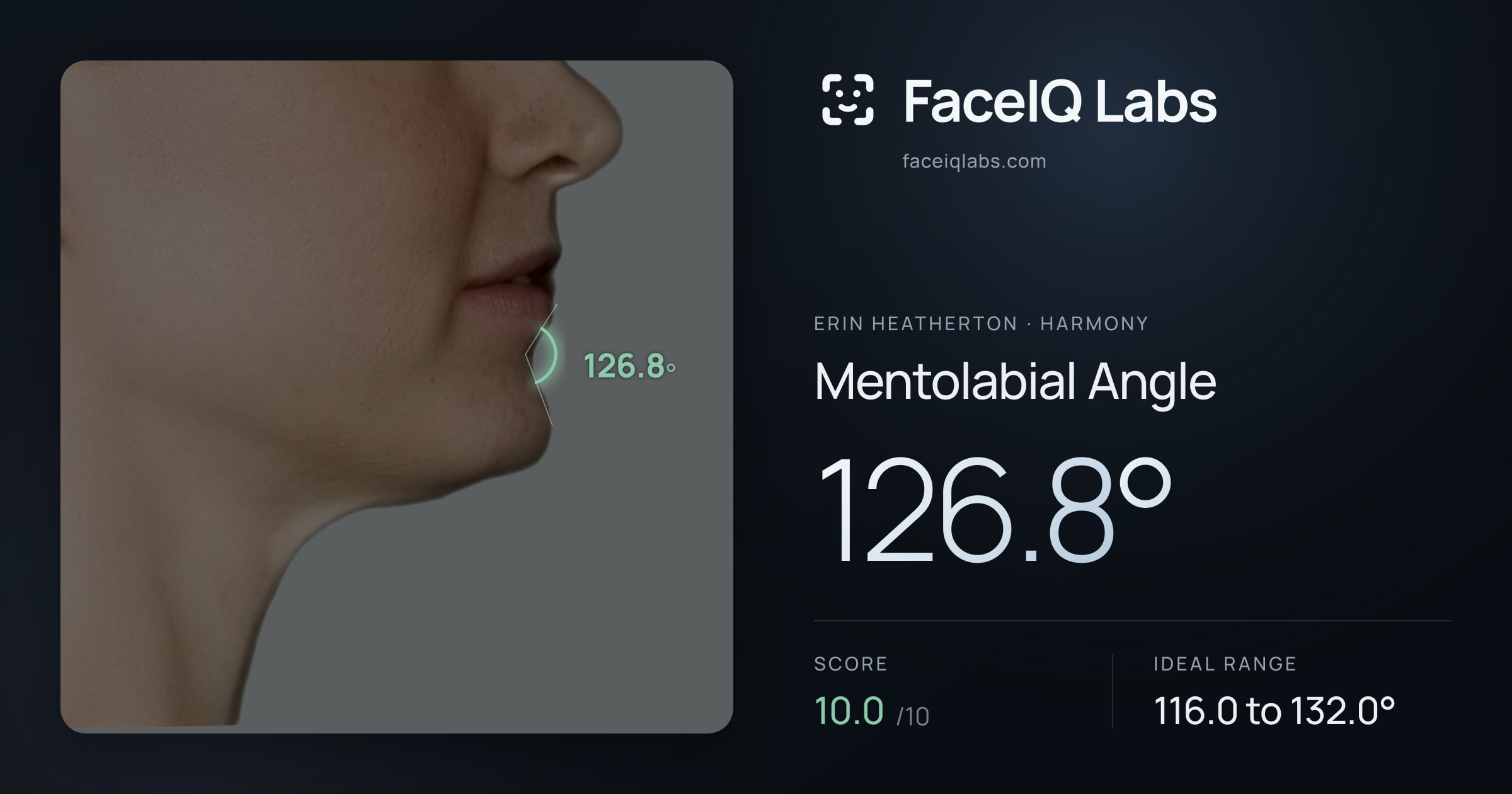 Erin Heatherton Mentolabial Angle: 126.8°, drawn on the photo