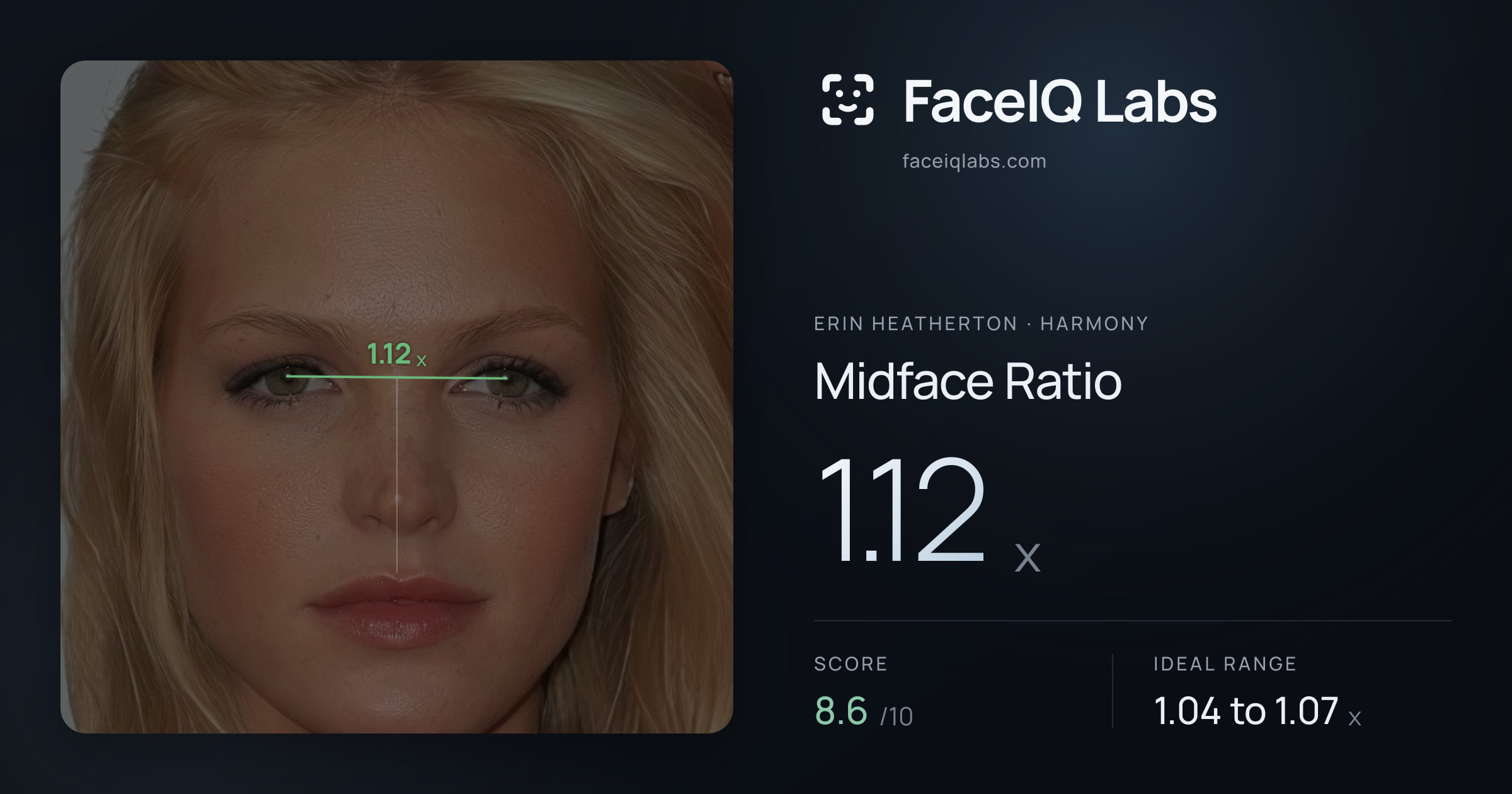 Erin Heatherton Midface Ratio: 1.12x, drawn on the photo