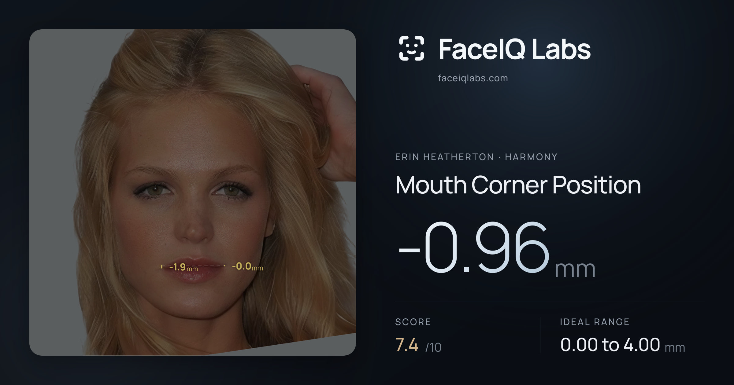 Erin Heatherton Mouth Corner Position: -0.96mm, drawn on the photo