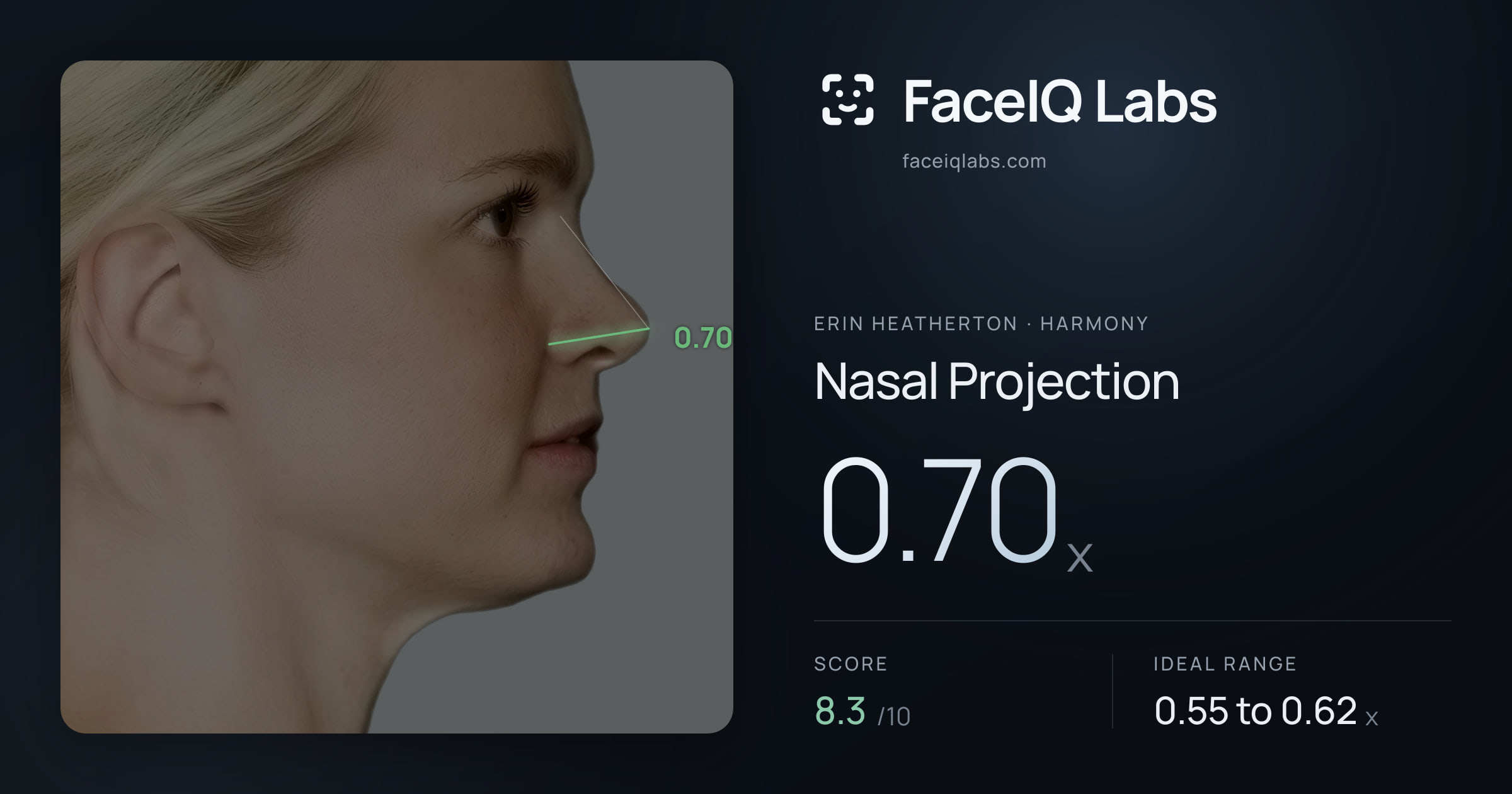 Erin Heatherton Nasal Projection: 0.70x, drawn on the photo