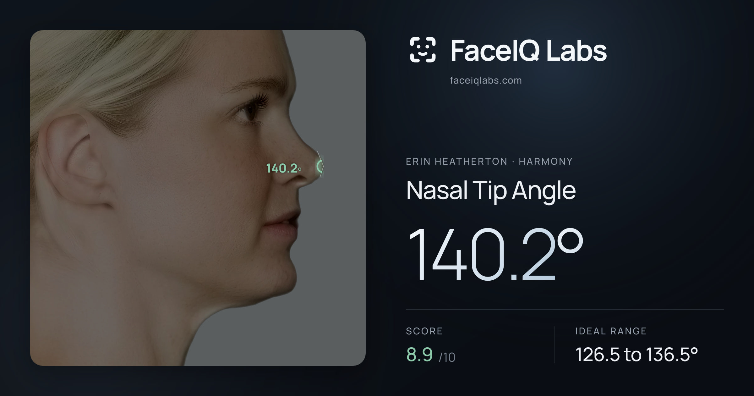 Erin Heatherton Nasal Tip Angle: 140.2°, drawn on the photo