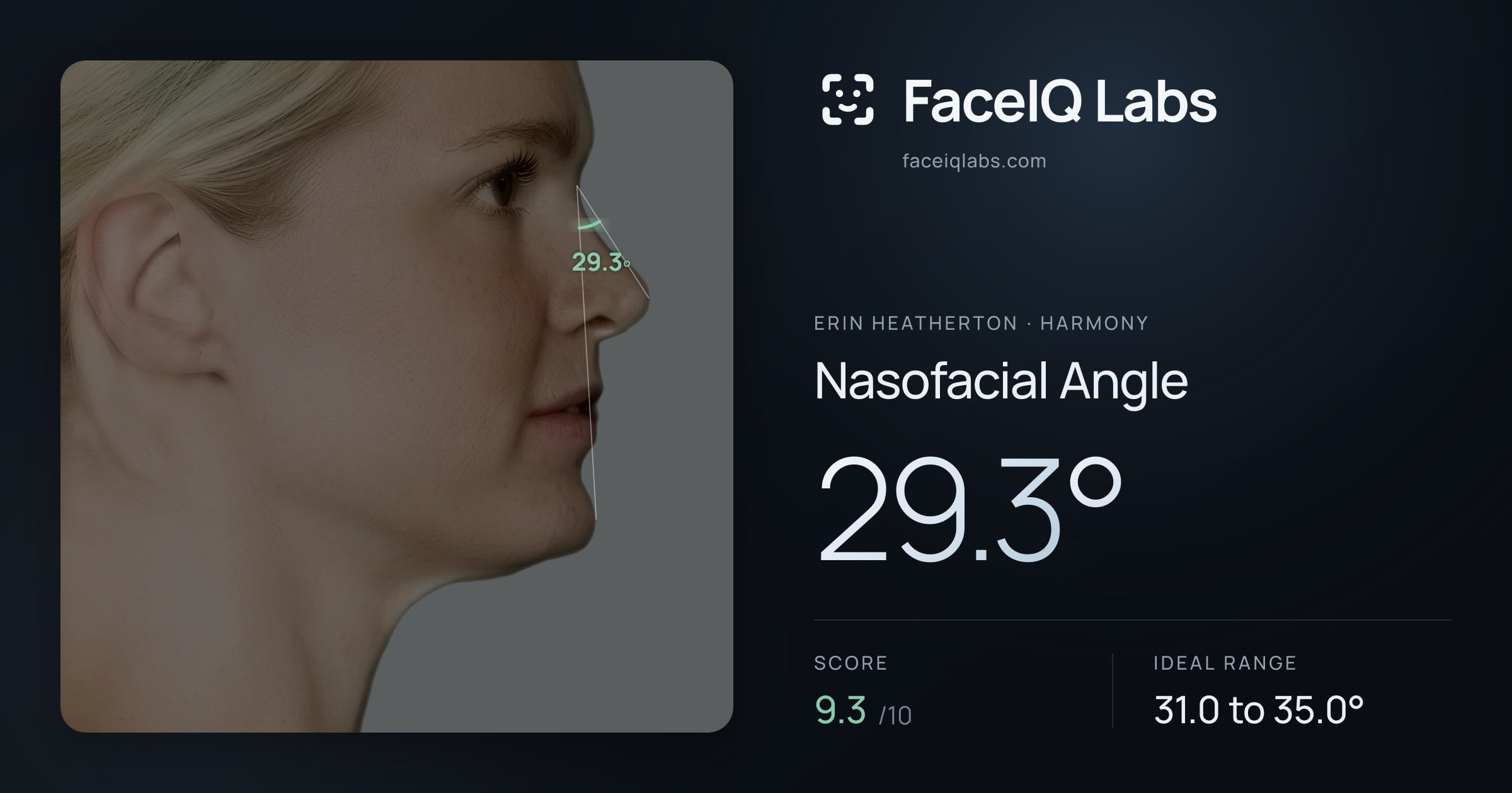 Erin Heatherton Nasofacial Angle: 29.3°, drawn on the photo