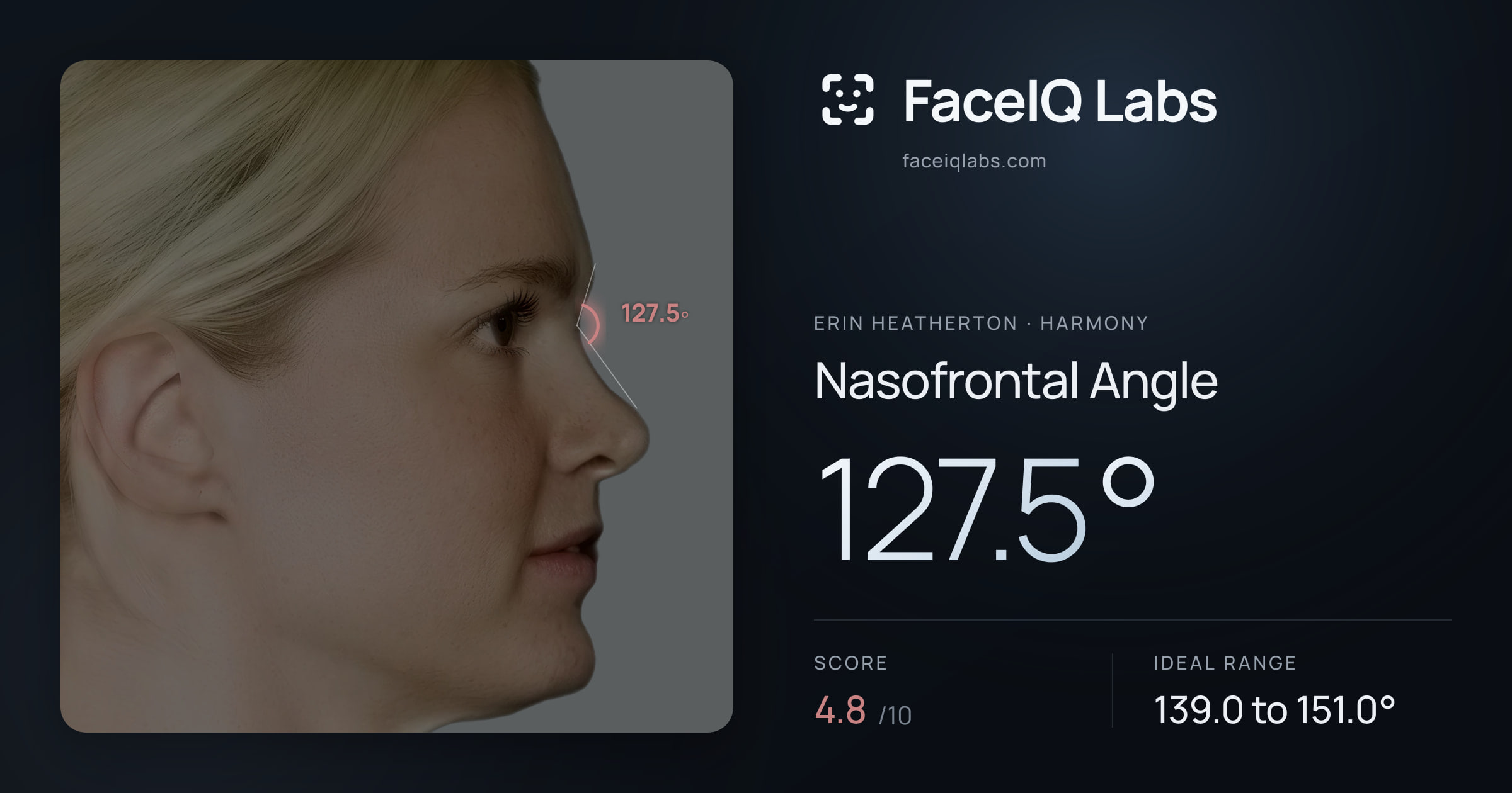 Erin Heatherton Nasofrontal Angle: 127.5°, drawn on the photo