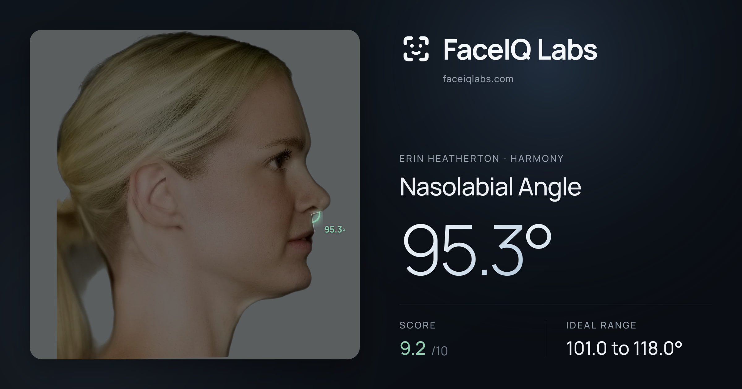 Erin Heatherton Nasolabial Angle: 95.3°, drawn on the photo