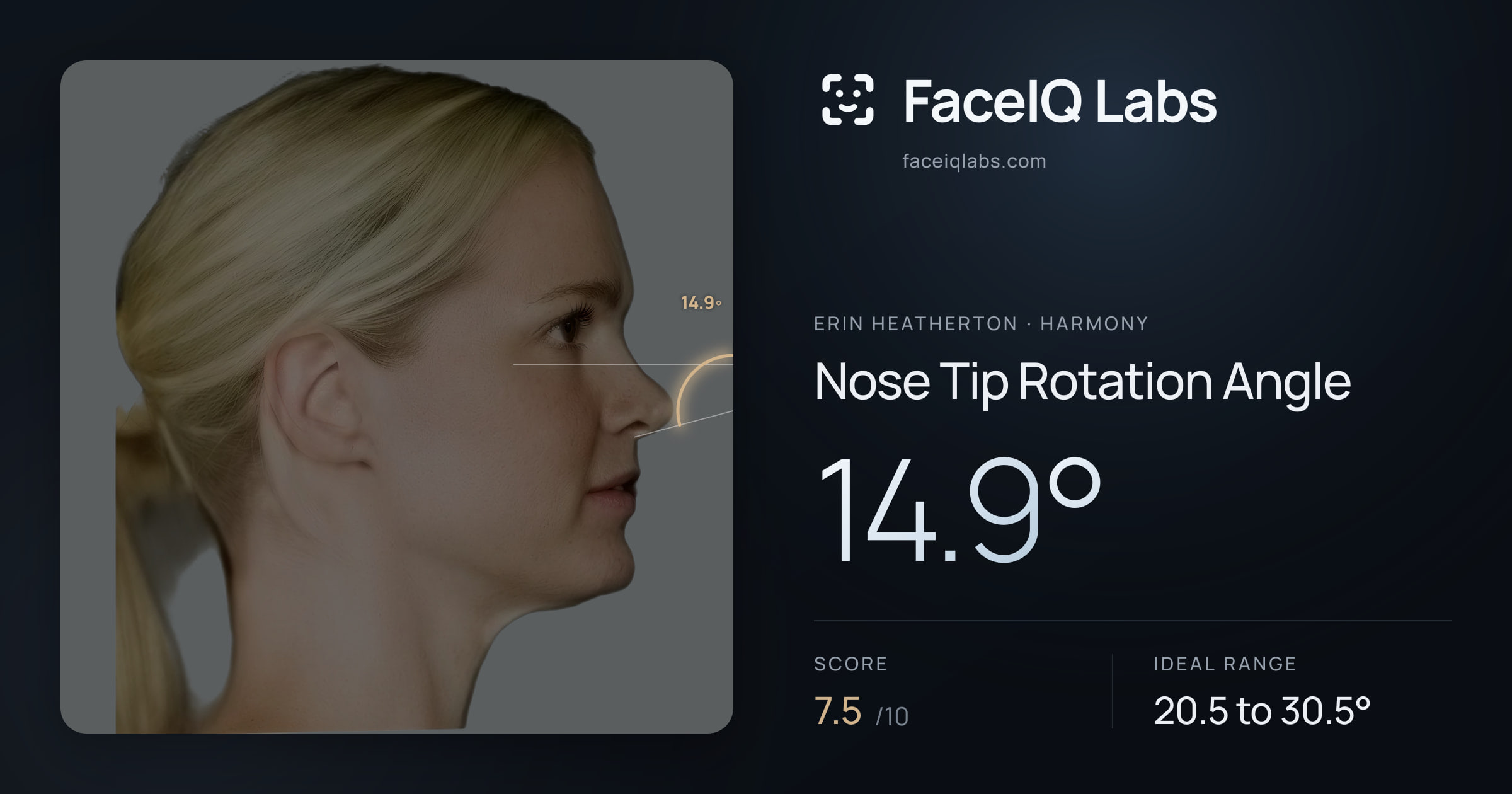 Erin Heatherton Nose Tip Rotation Angle: 14.9°, drawn on the photo