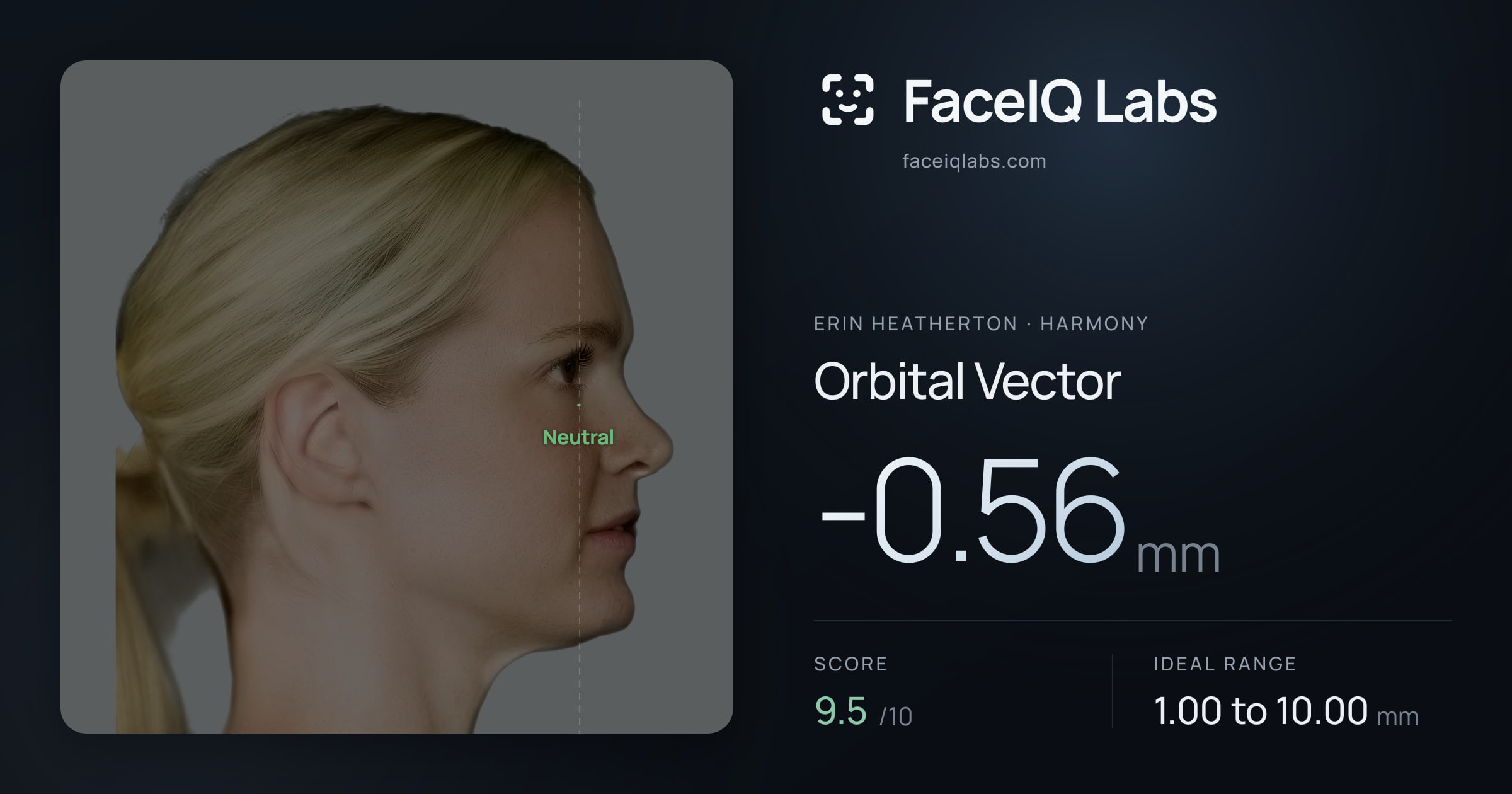 Erin Heatherton Orbital Vector: -0.56mm, drawn on the photo
