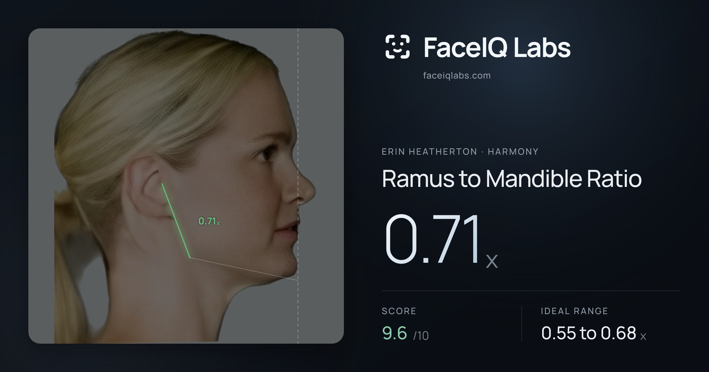 Erin Heatherton Ramus to Mandible Ratio: 0.71x, drawn on the photo