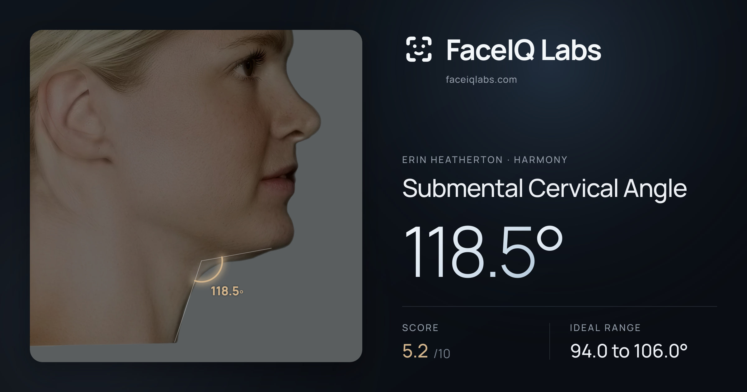 Erin Heatherton Submental Cervical Angle: 118.5°, drawn on the photo