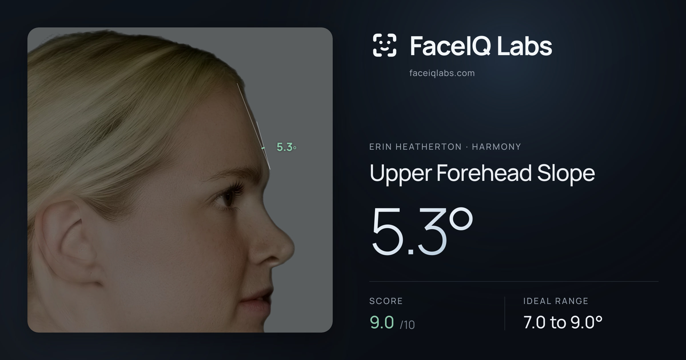 Erin Heatherton Upper Forehead Slope: 5.3°, drawn on the photo