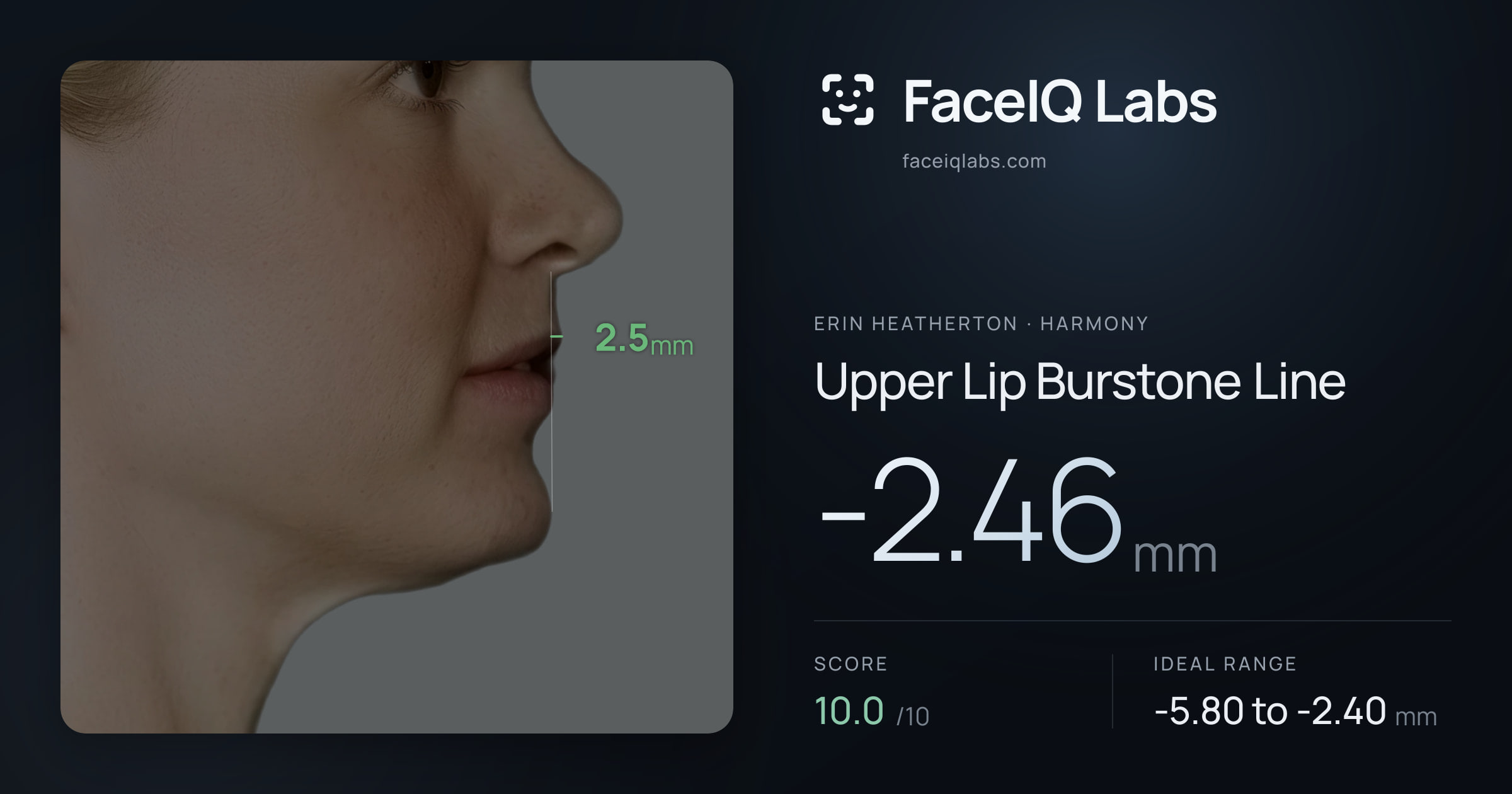 Erin Heatherton Upper Lip Burstone Line: -2.46mm, drawn on the photo