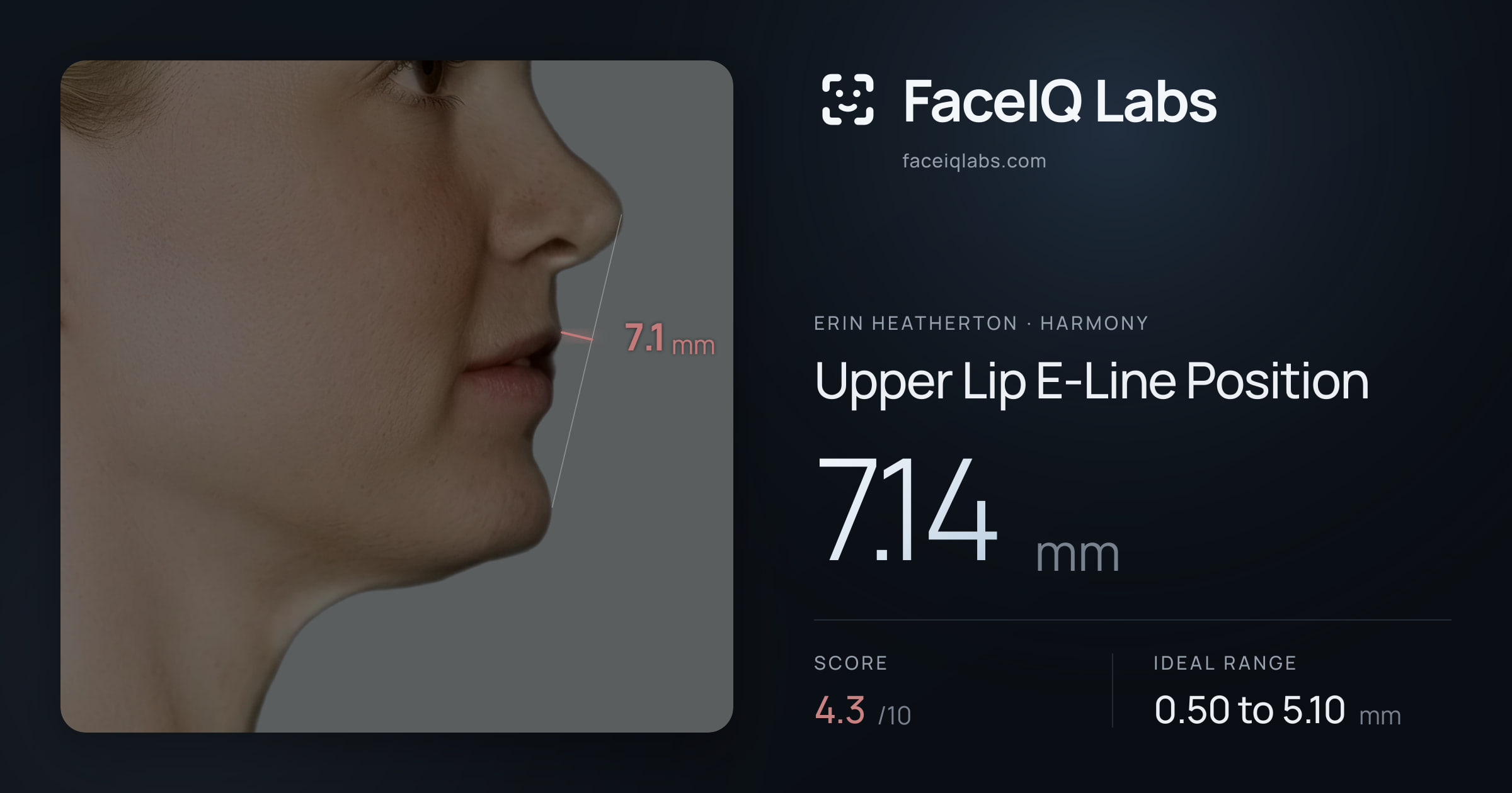 Erin Heatherton Upper Lip E-Line Position: 7.14mm, drawn on the photo