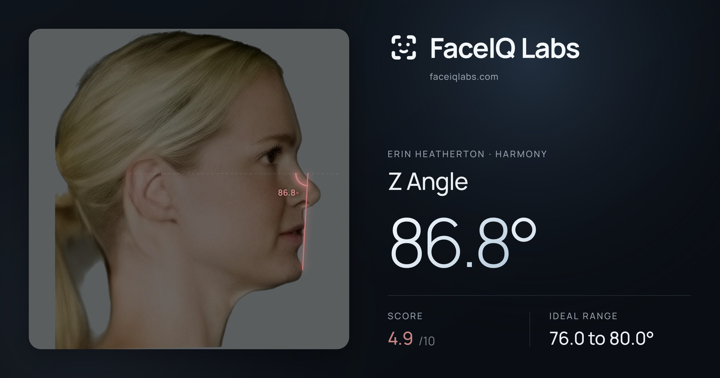Erin Heatherton Z Angle: 86.8°, drawn on the photo