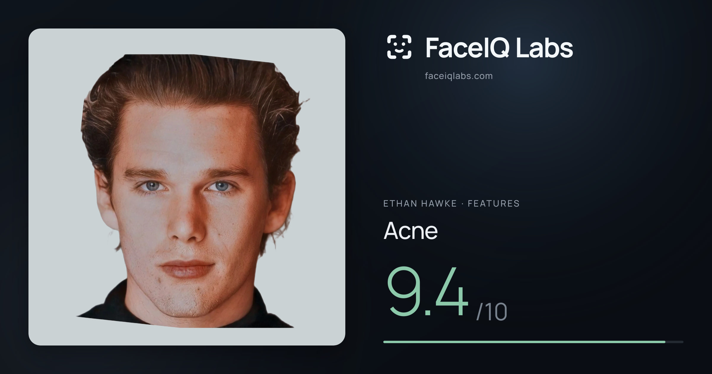 Ethan Hawke Acne: 9.4/10, drawn on the photo